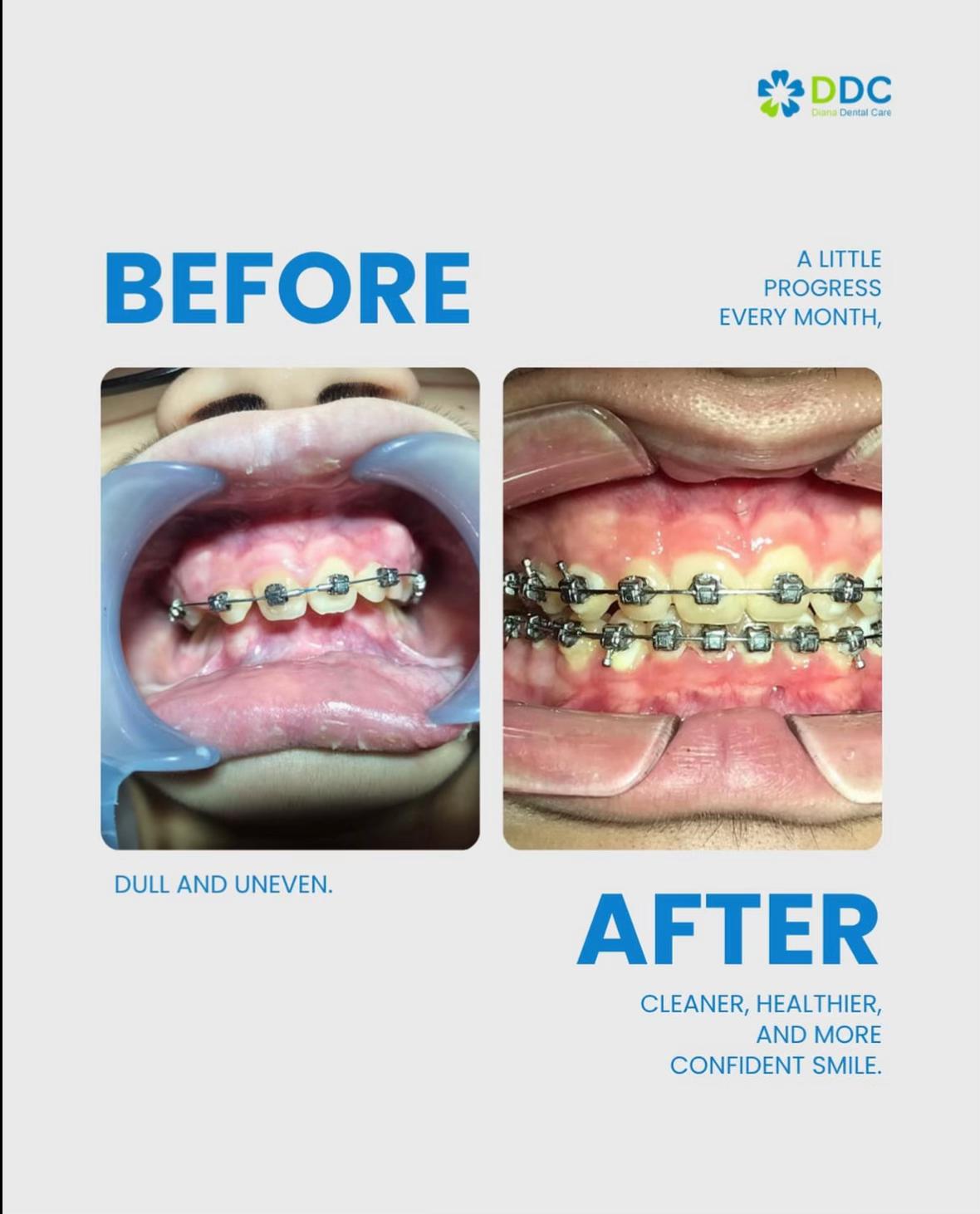 @Diana Dental Care