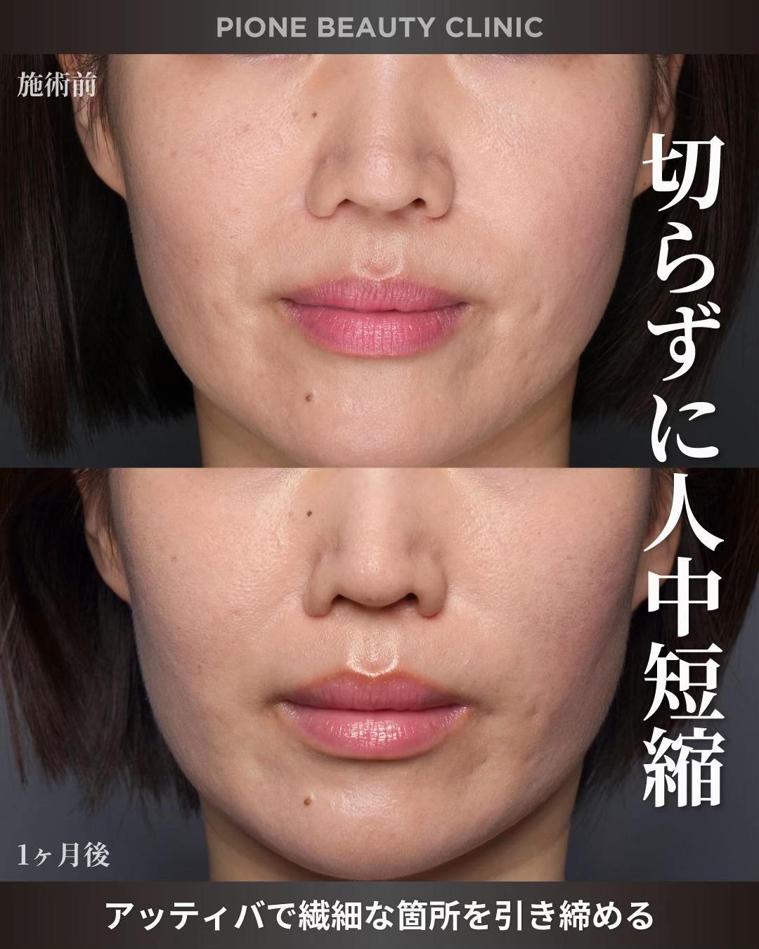 @金澤紀臣【小顔/若返り/脂肪吸引】