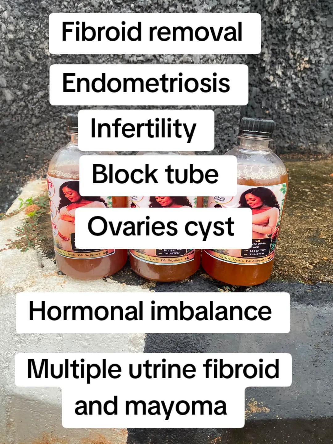 @omega fibroid removal herbs