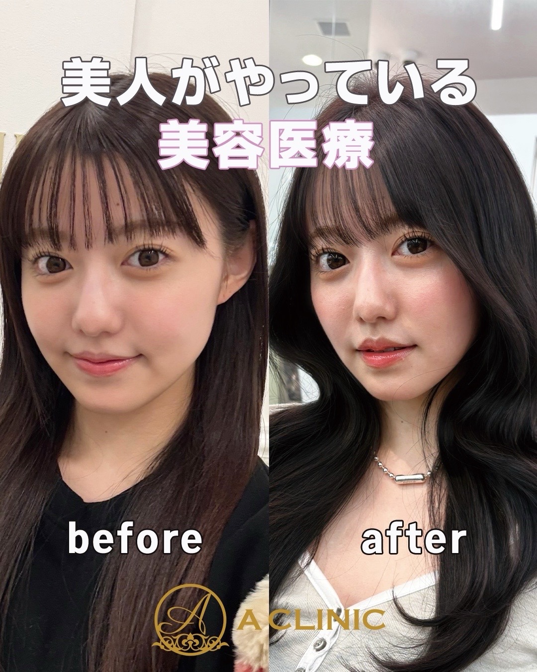 @ACLINIC池袋院【小顔/中顔面短縮】