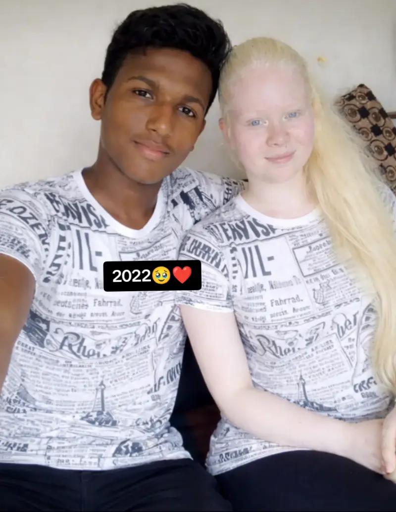 @🧝🤍Albino Girl LK🤍🧝🩵