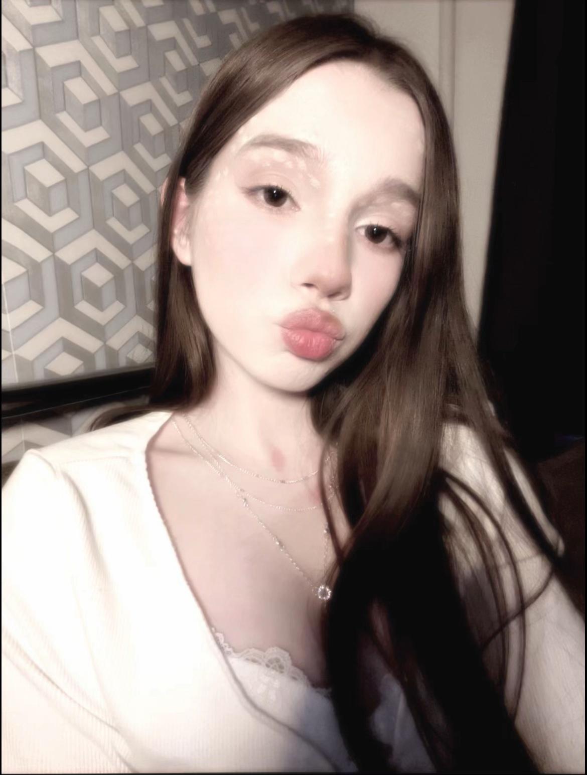 @sd