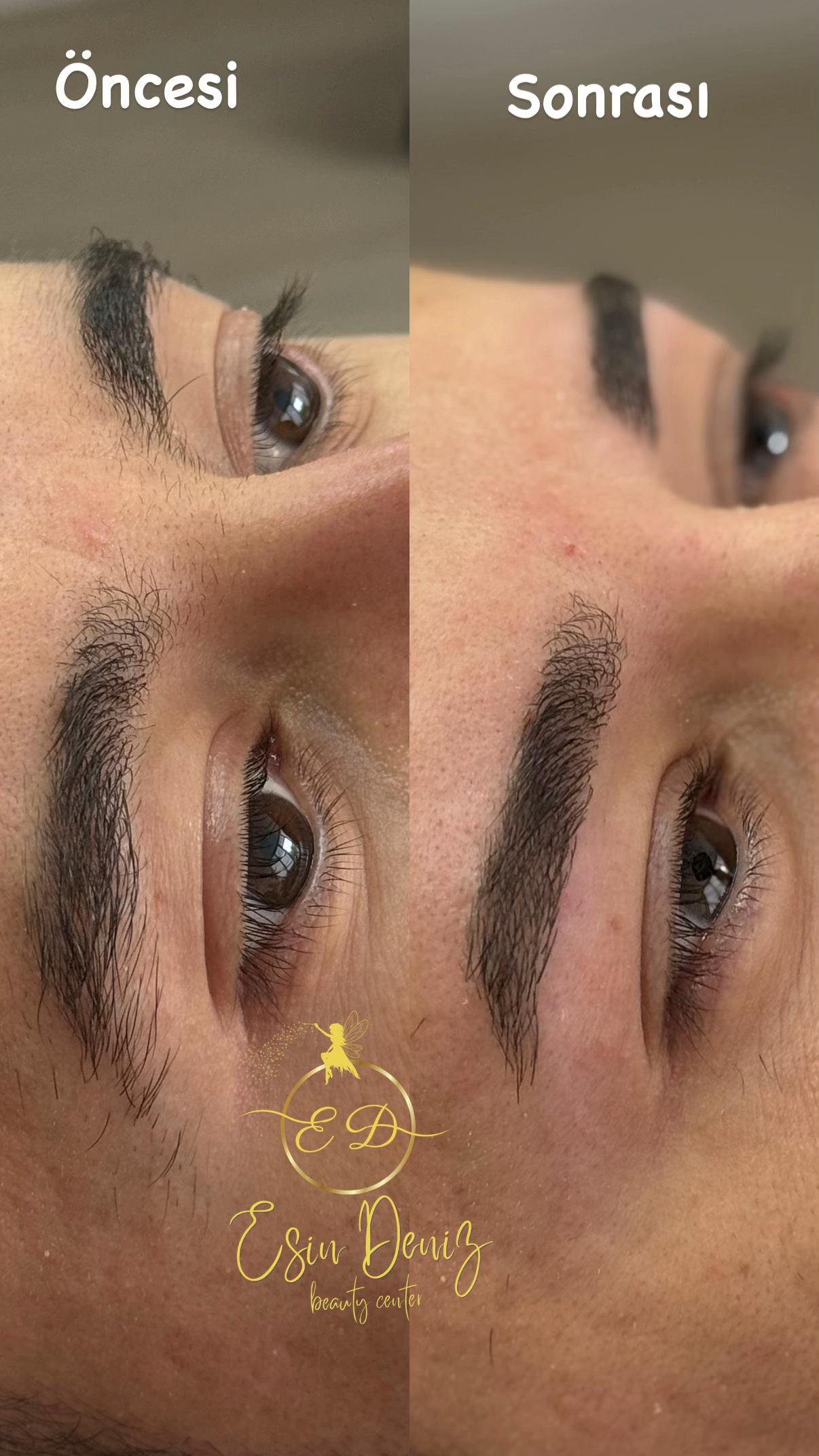 @Esin Deniz Beauty center