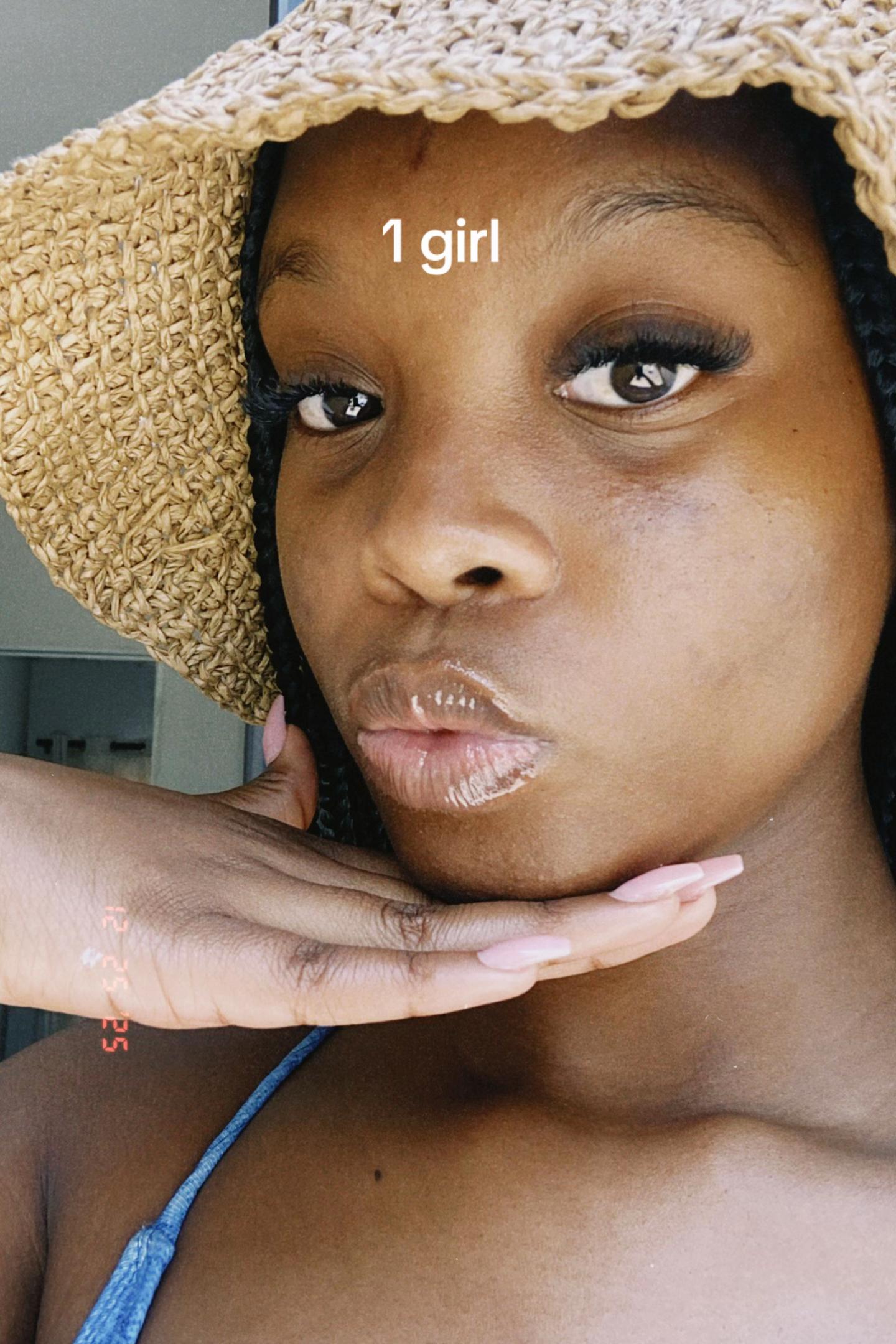 @N. Radebe