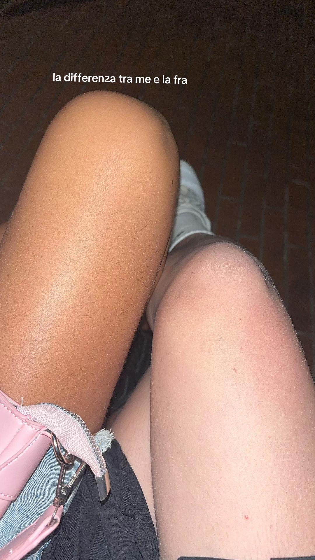 @🌟🫶🏼🤭