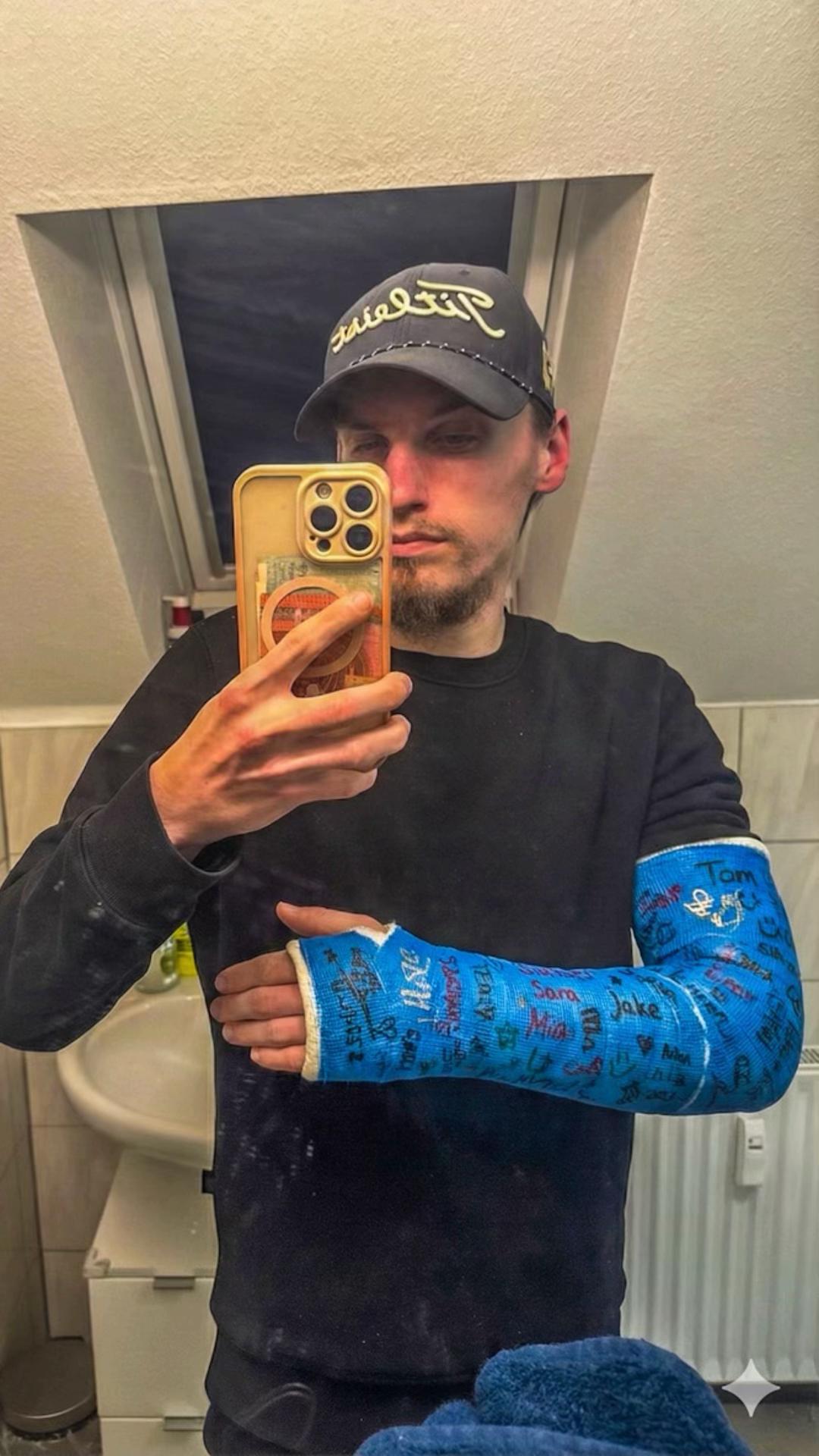 @Gips Fetish