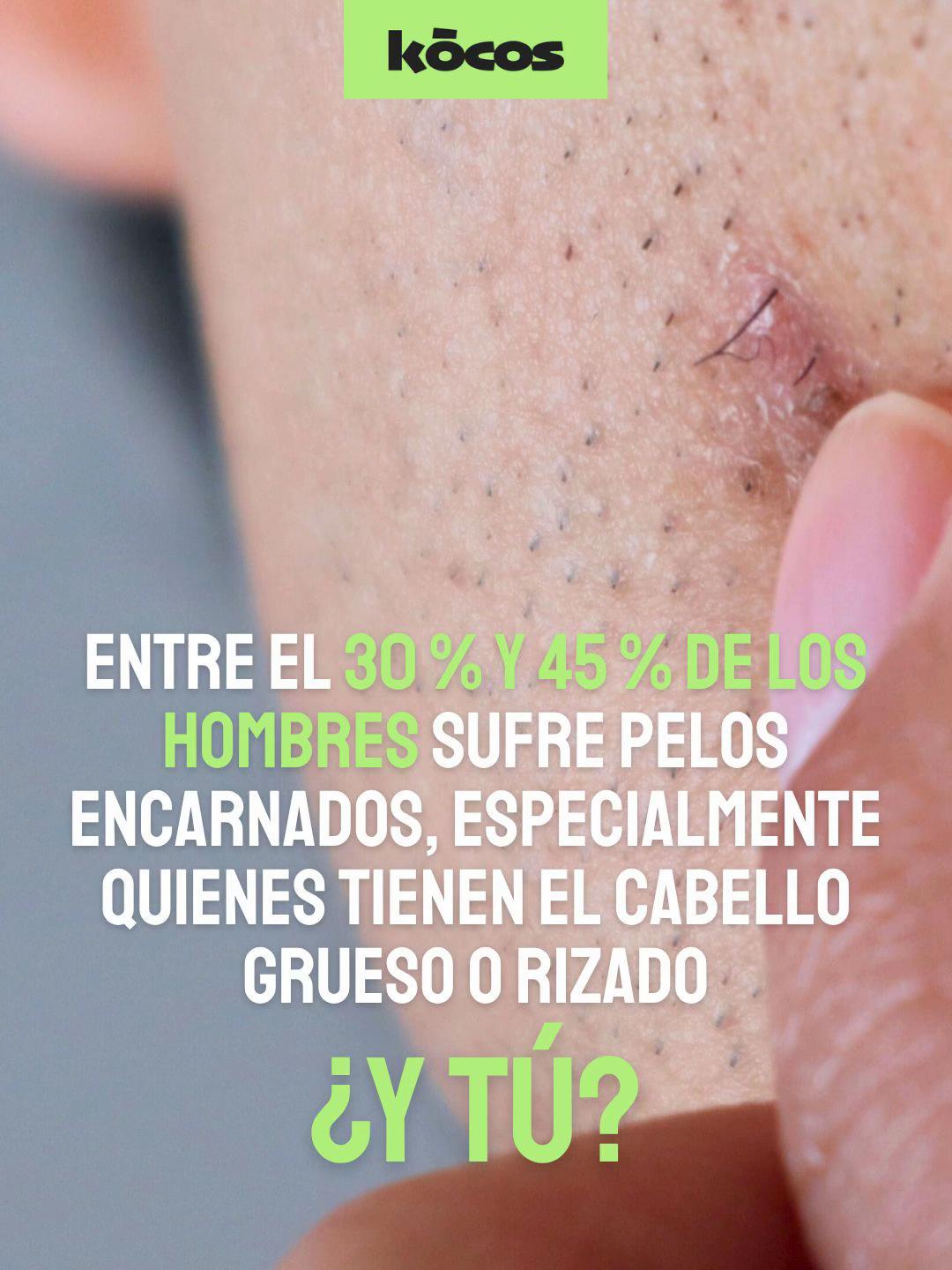 @Kocos_es