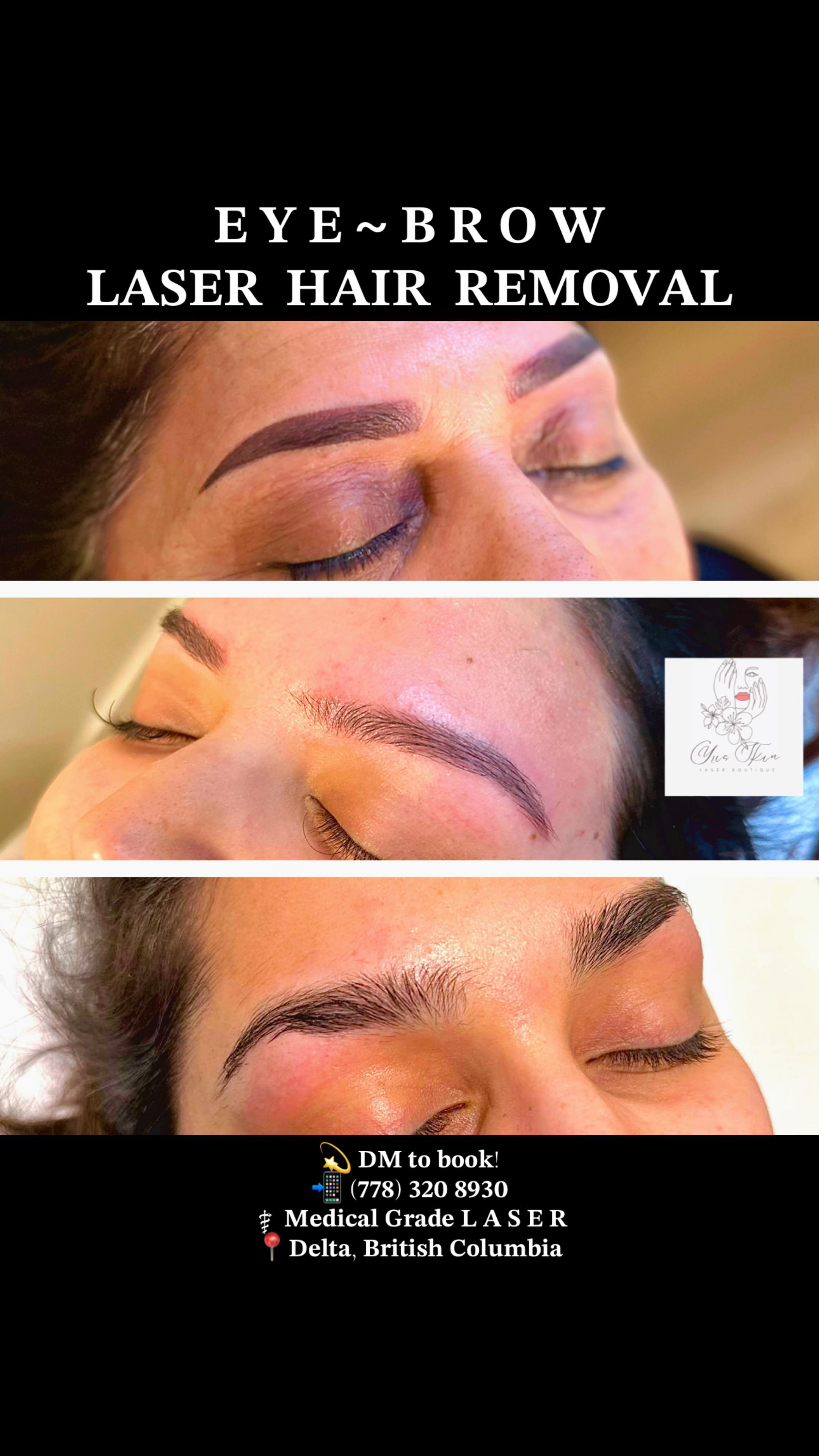 @Yris Skin Laser Boutique Delta