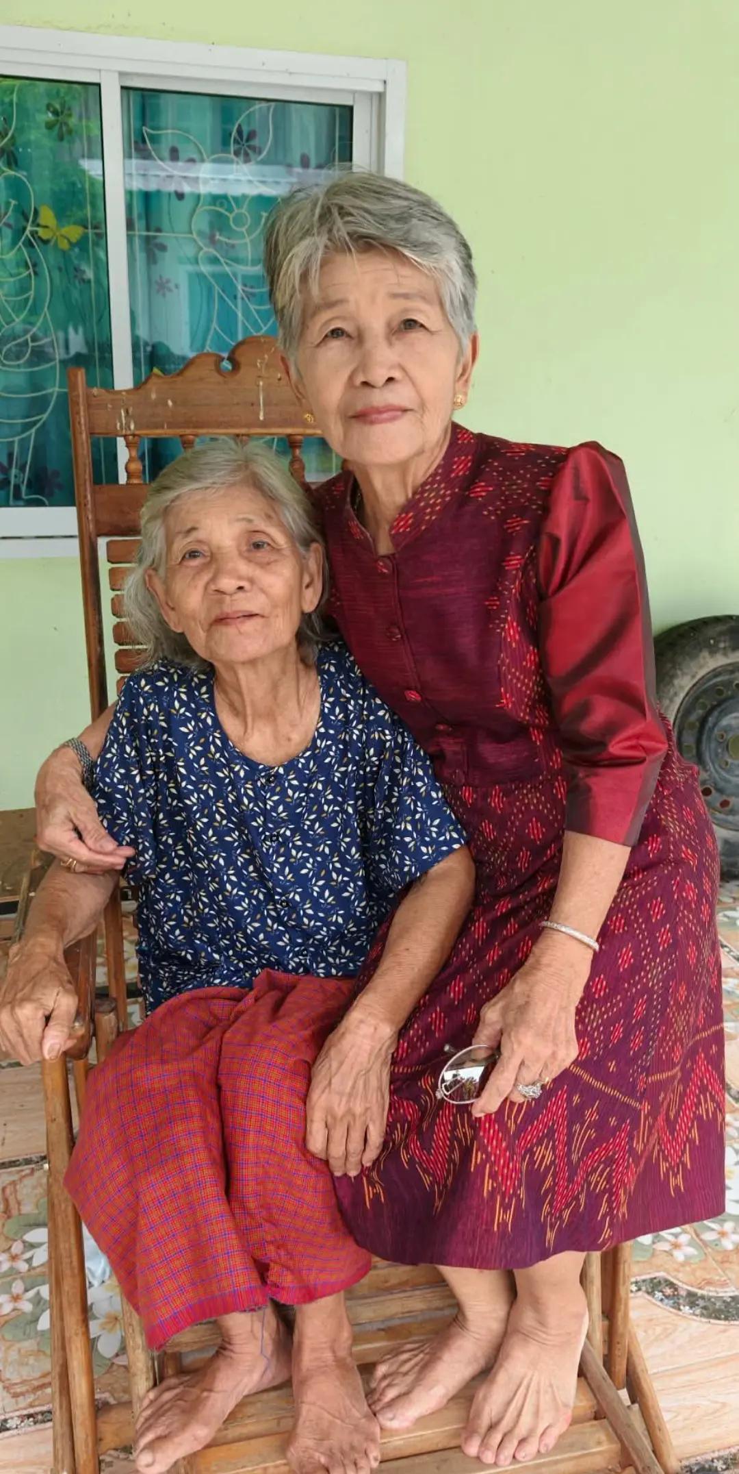 @บู้บี้เด็กหัวโตมีน้ำในโพรงสมอง