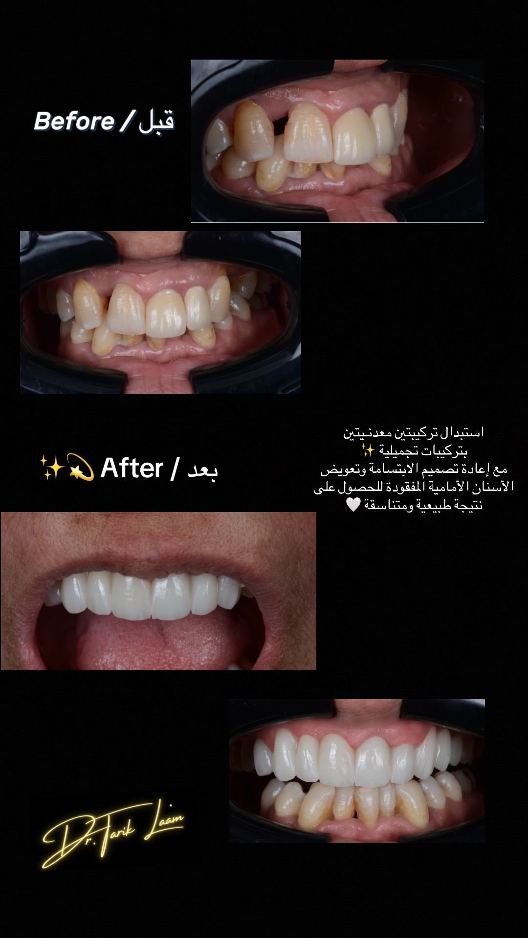 @Dr.tarik_laam