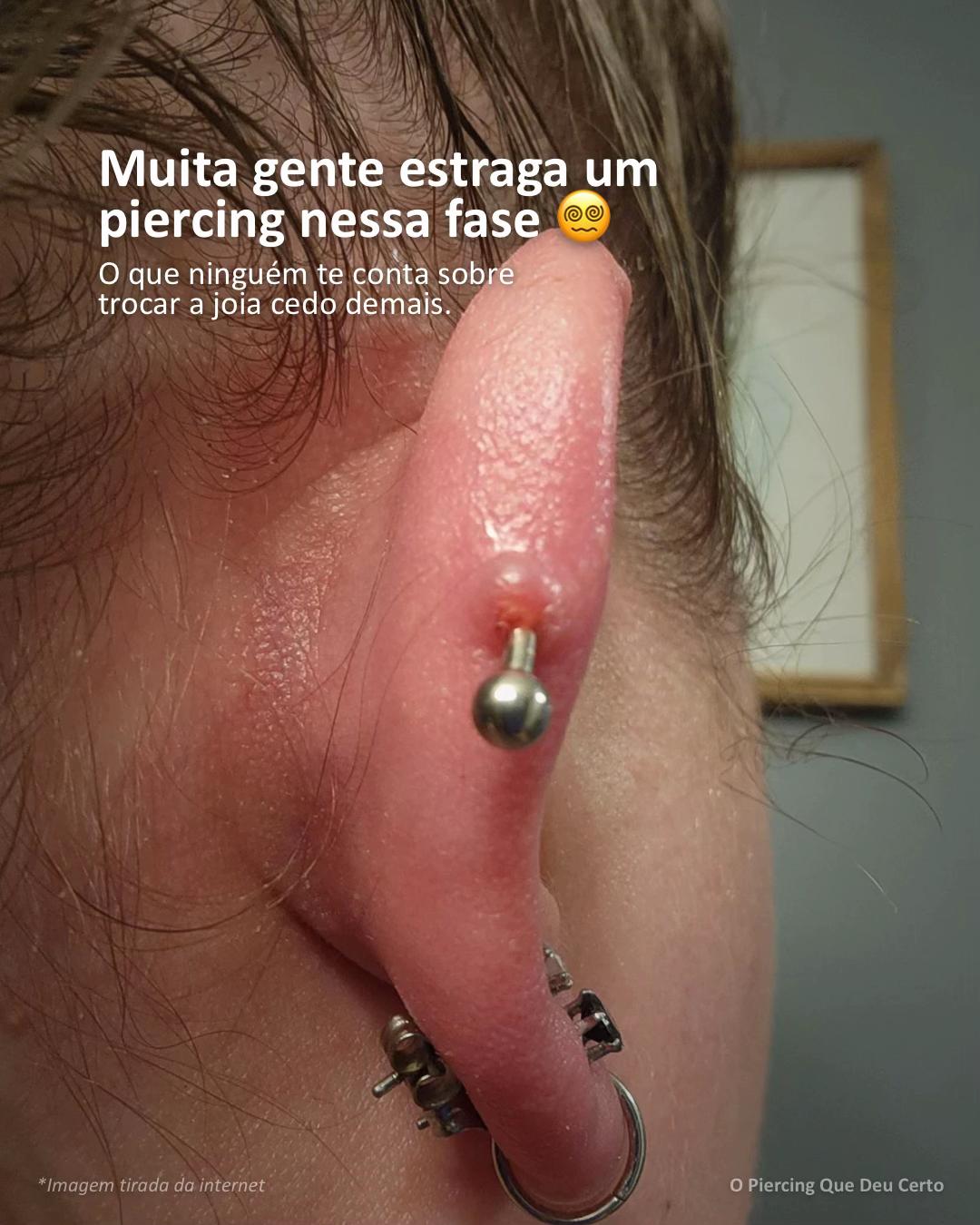 @Igor Sudano