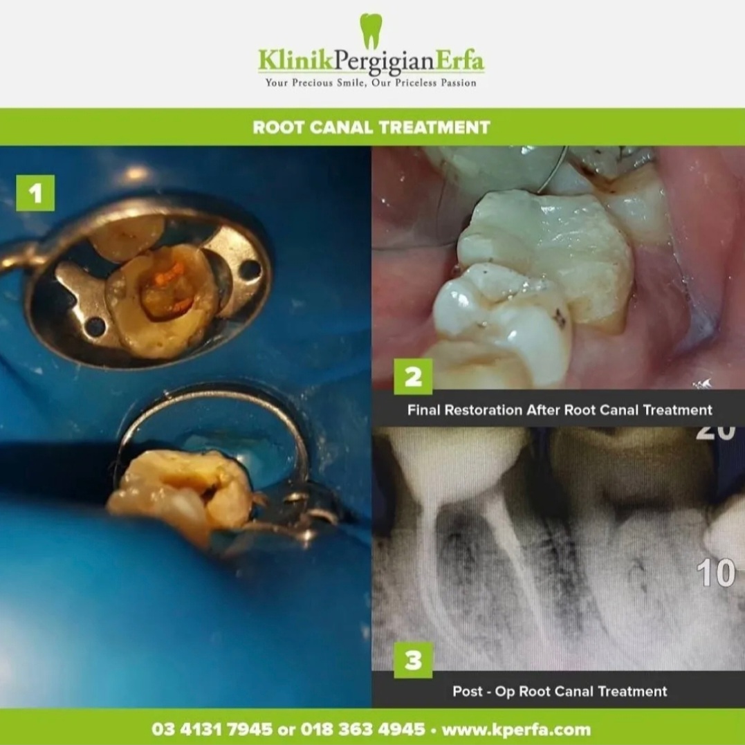 @Klinik Pergigian Erfa