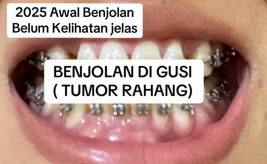 @Ulfa