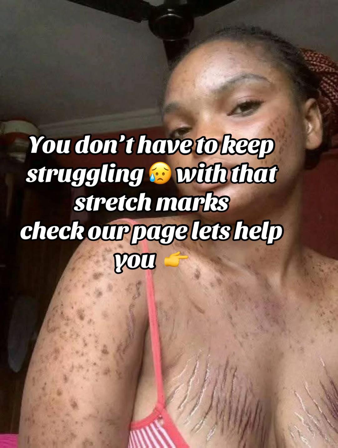 @Radiant skin