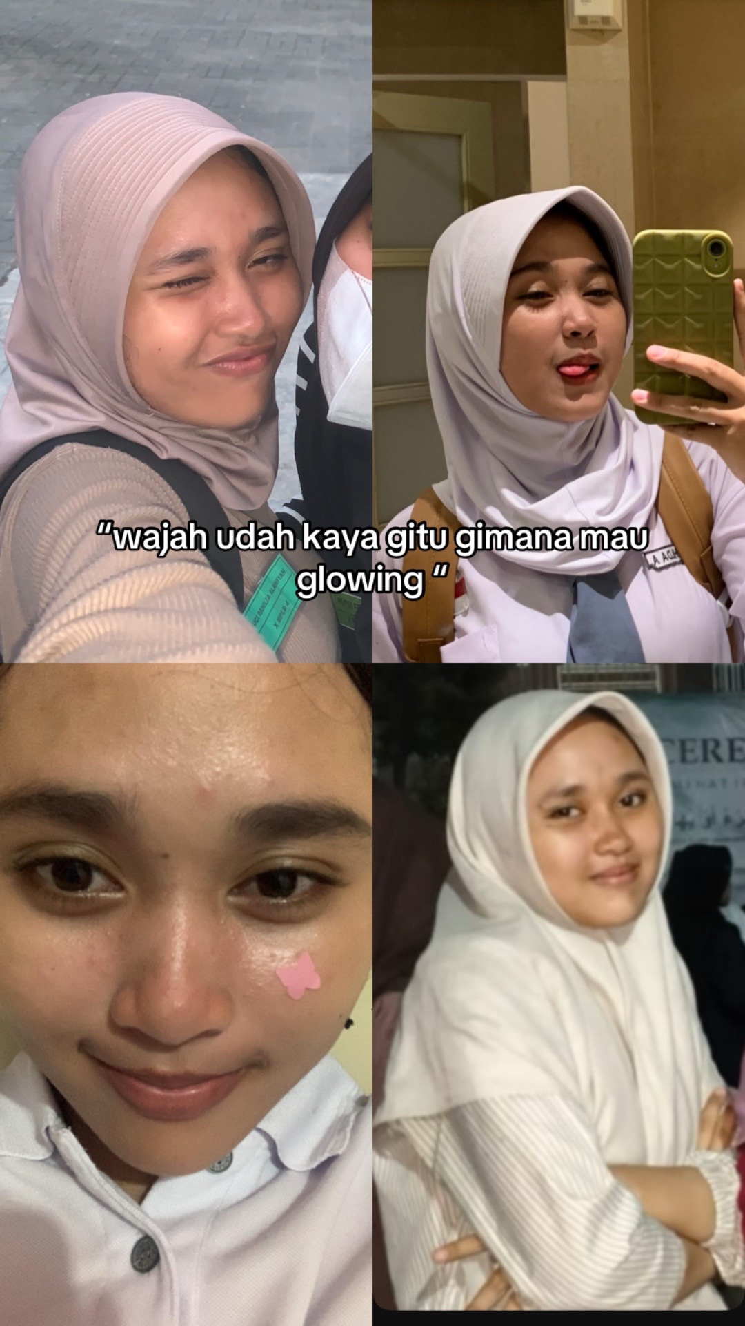 @ucie