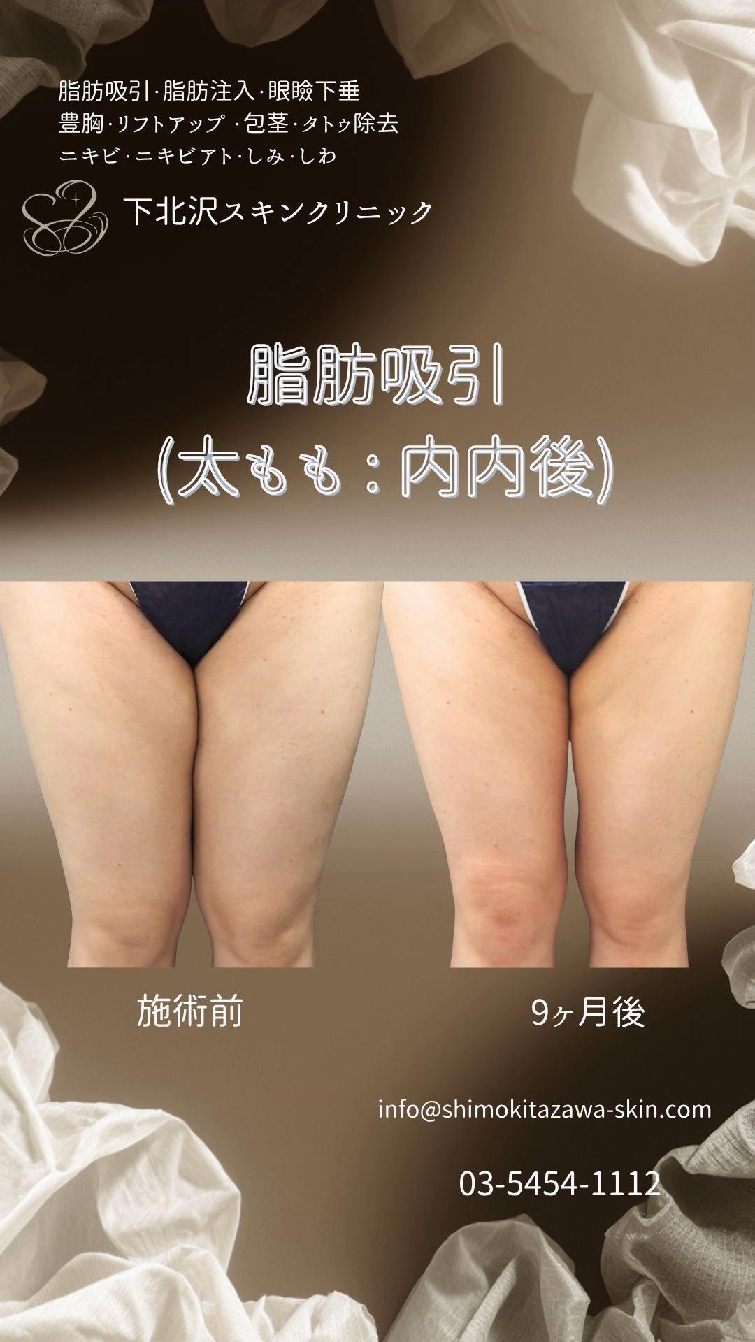 @下北沢スキンクリニック院長・こころの美容外科医・保坂宗孝