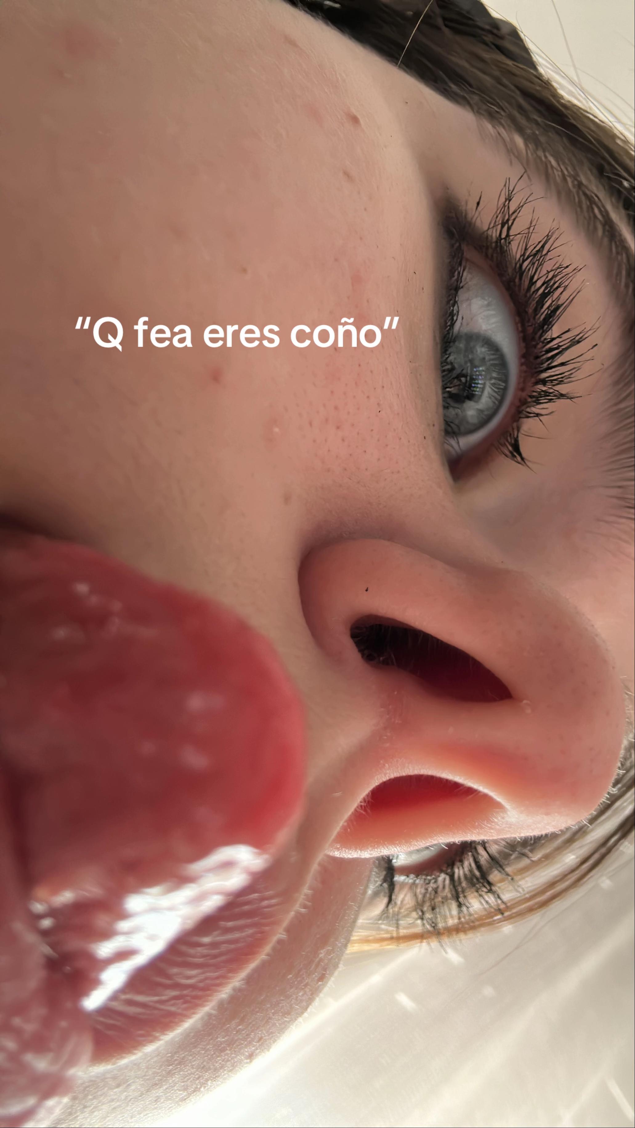 @🎷🐛🥐