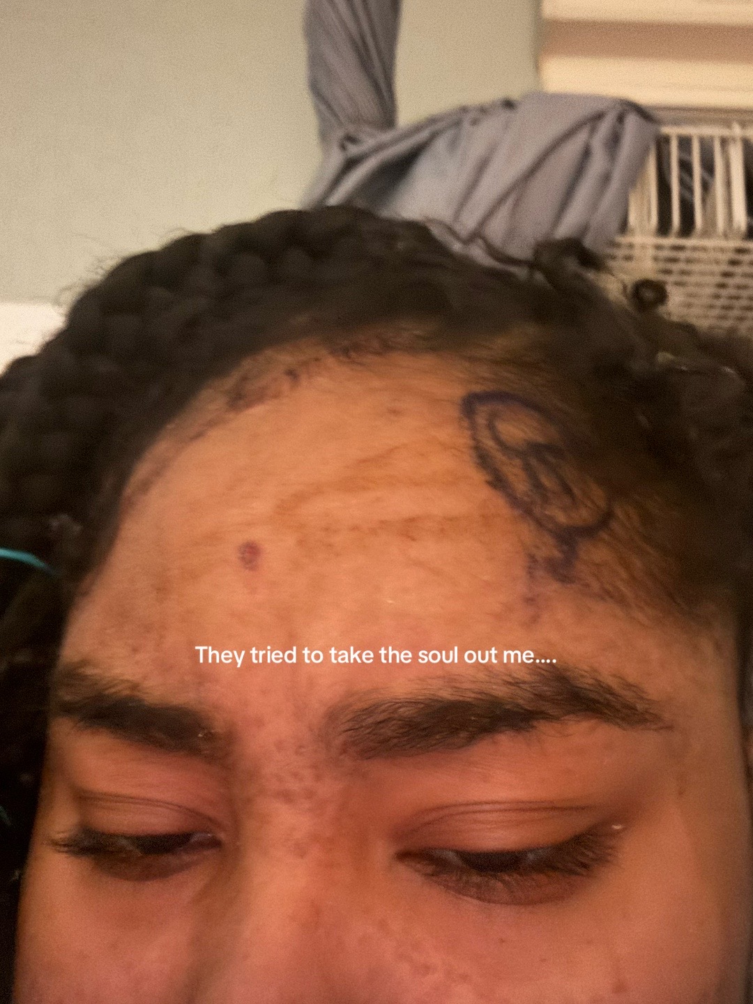 @Vega🎗️