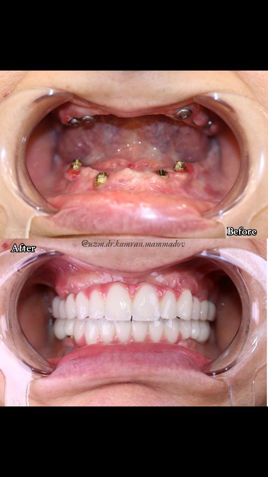 @dr.kamranmammadov