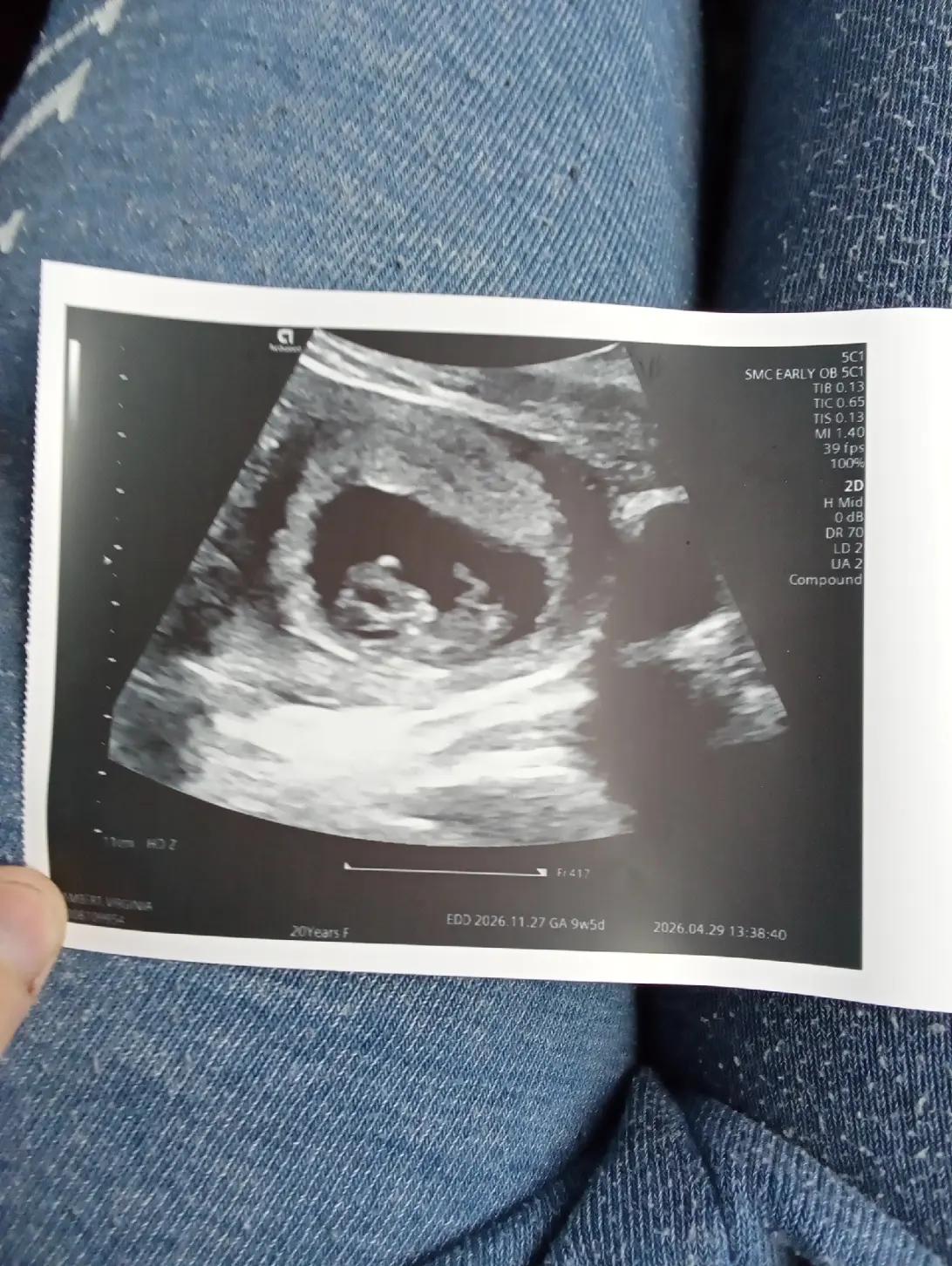 @Gracie|girl mom to be 🩷