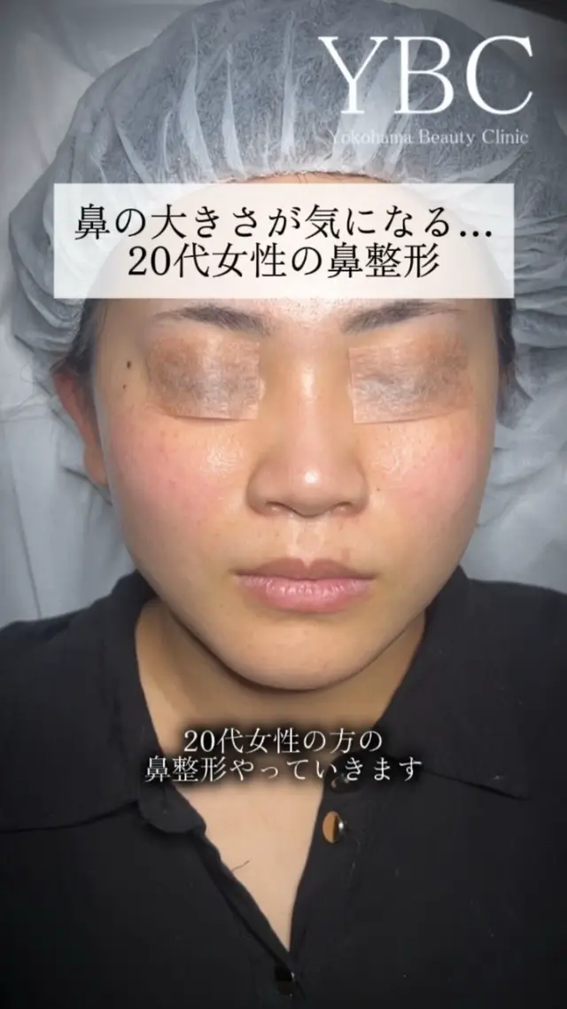 @イソセン/美容外科医（磯村亮輔院長）