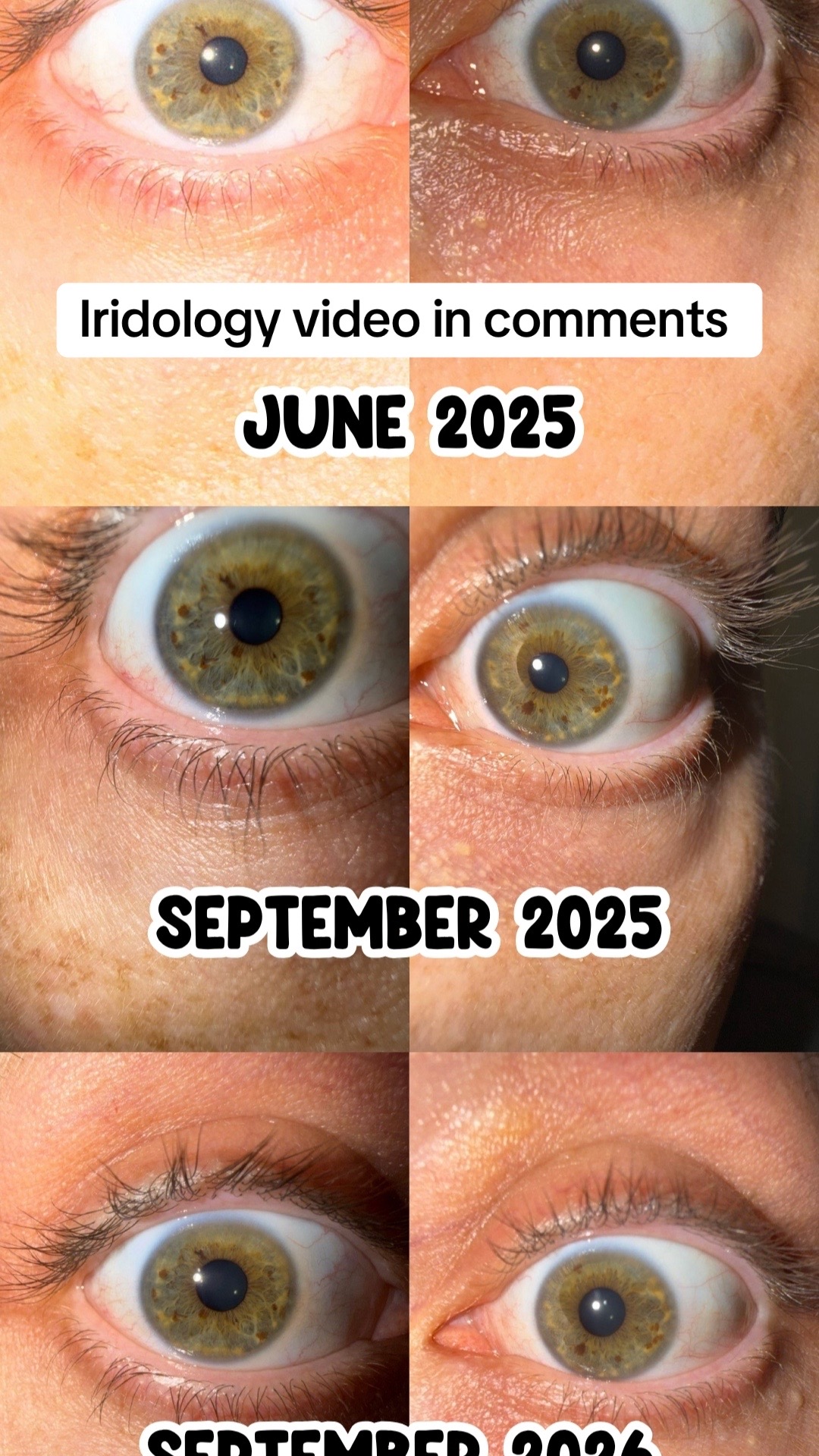 @Health2Longevity