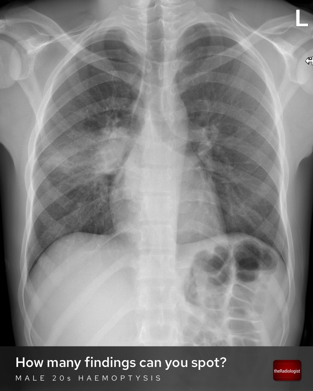 @The Radiologist