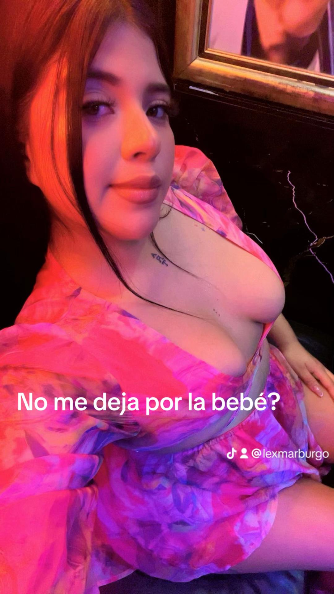 @Lexmar Burgo