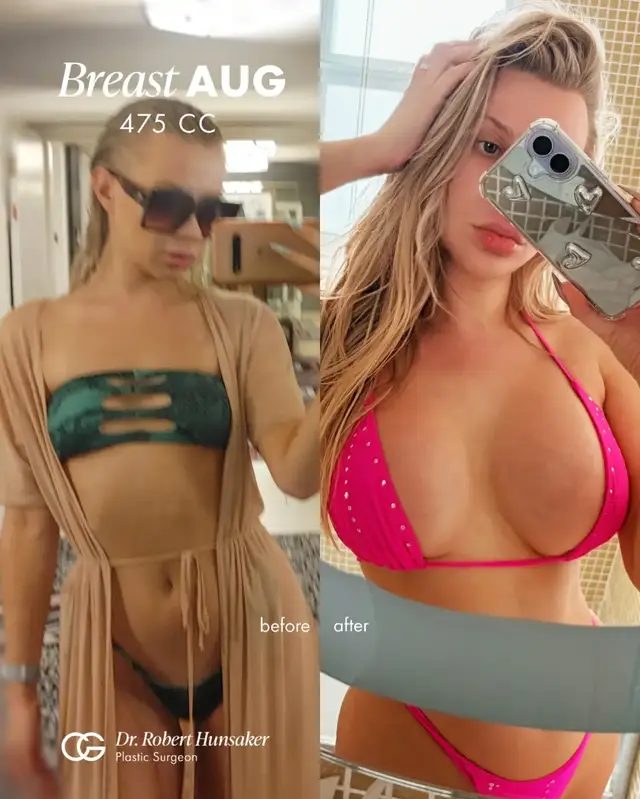 @CG Cosmetic Surgery | Miami