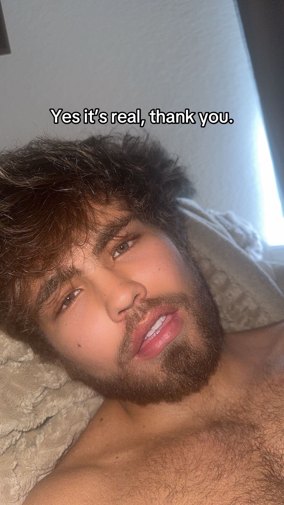 @Brae