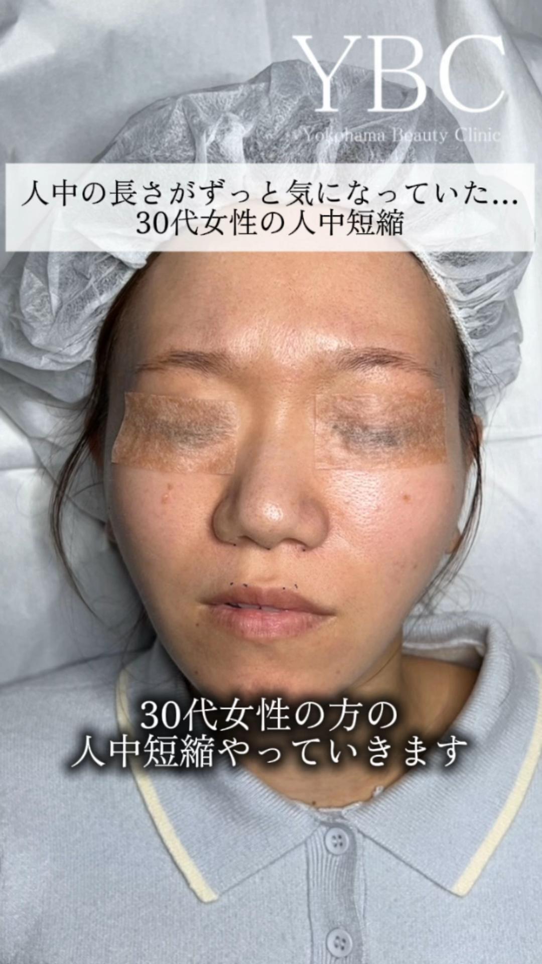 @イソセン/美容外科医（磯村亮輔院長）