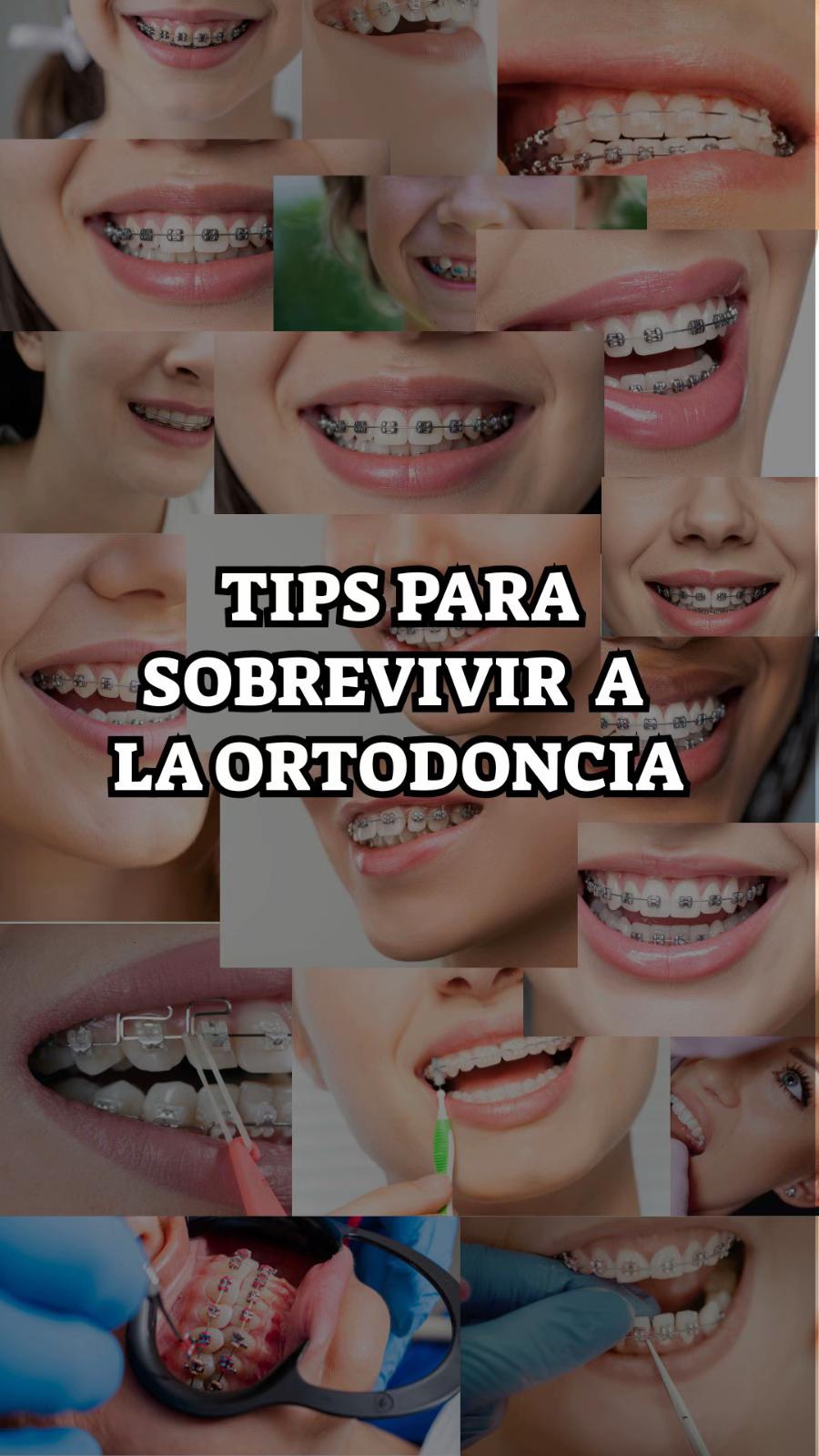 @Brackets y Alineadores