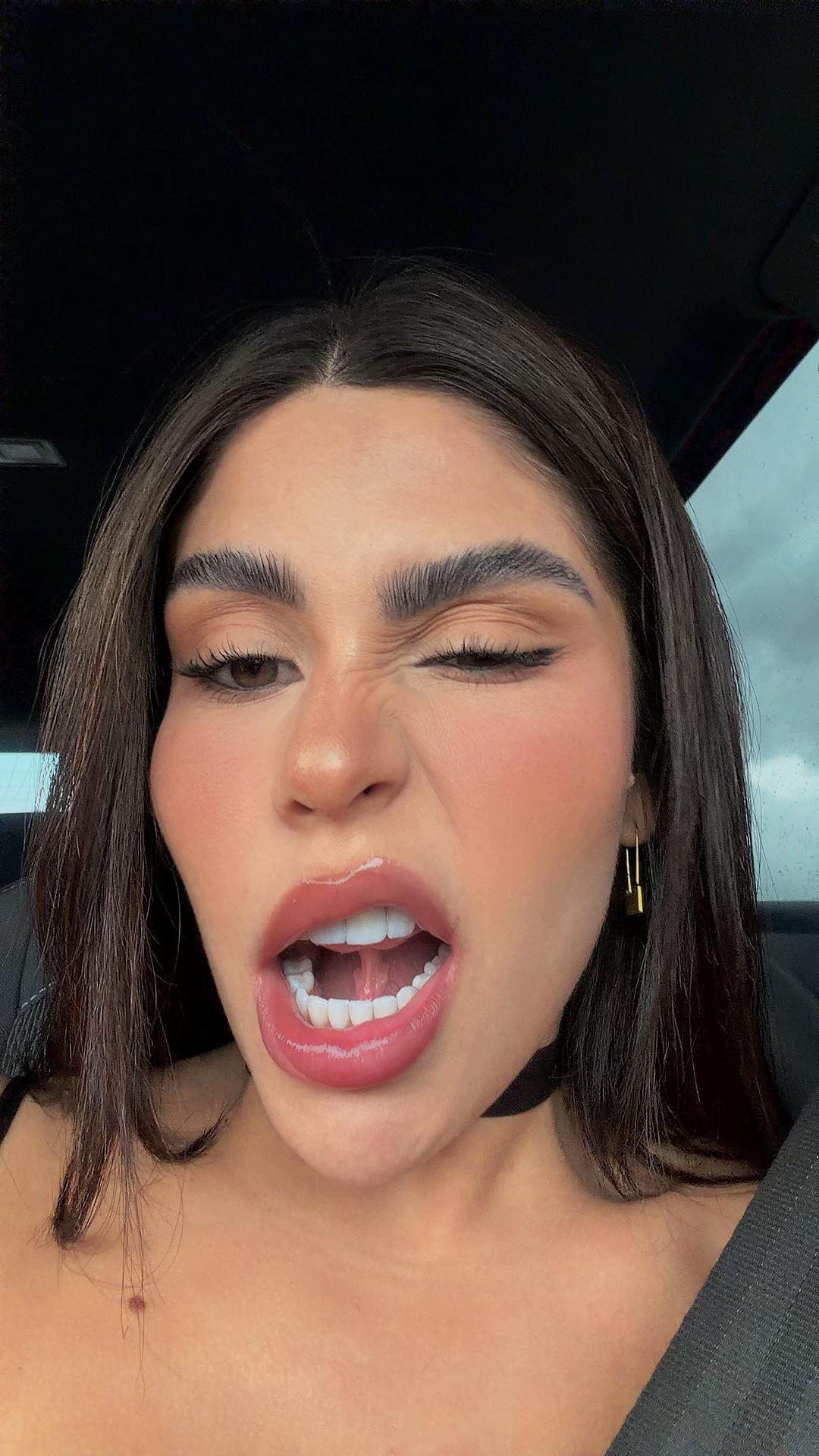 @Ana clara Teodosiooo