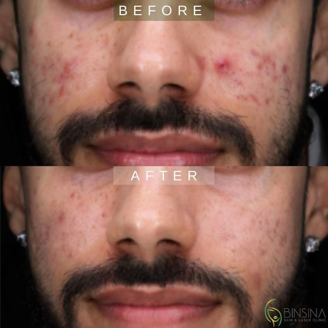 @Binsina Laser & Skin Clinic
