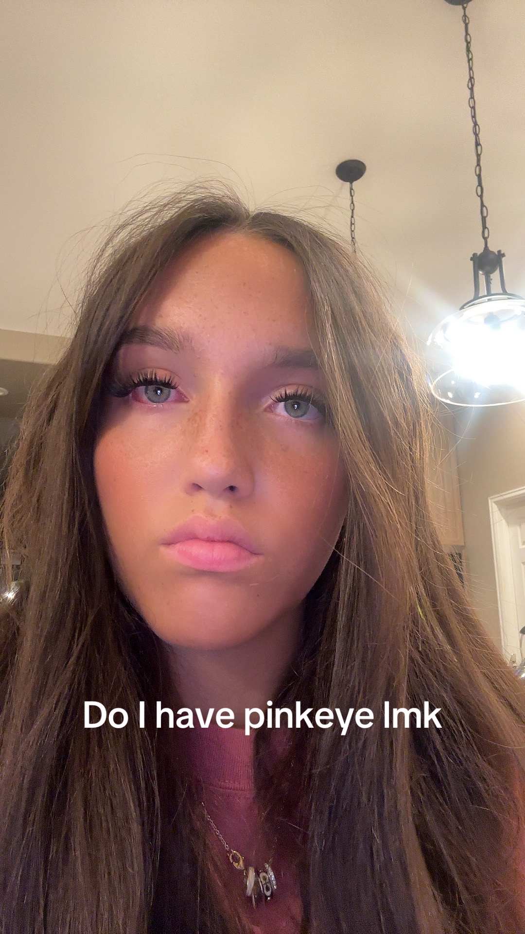 @Lash