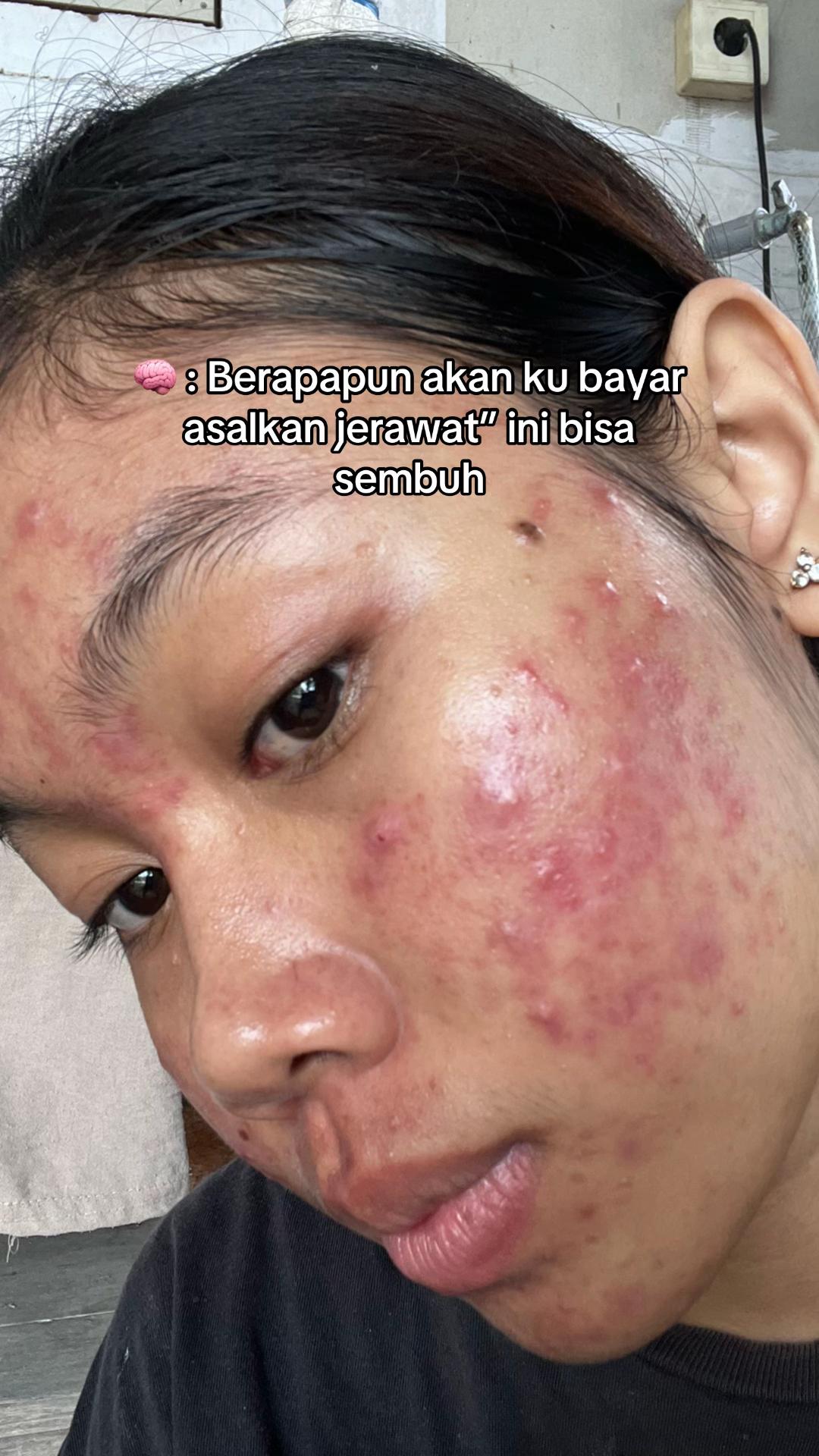 @Nina Marselina