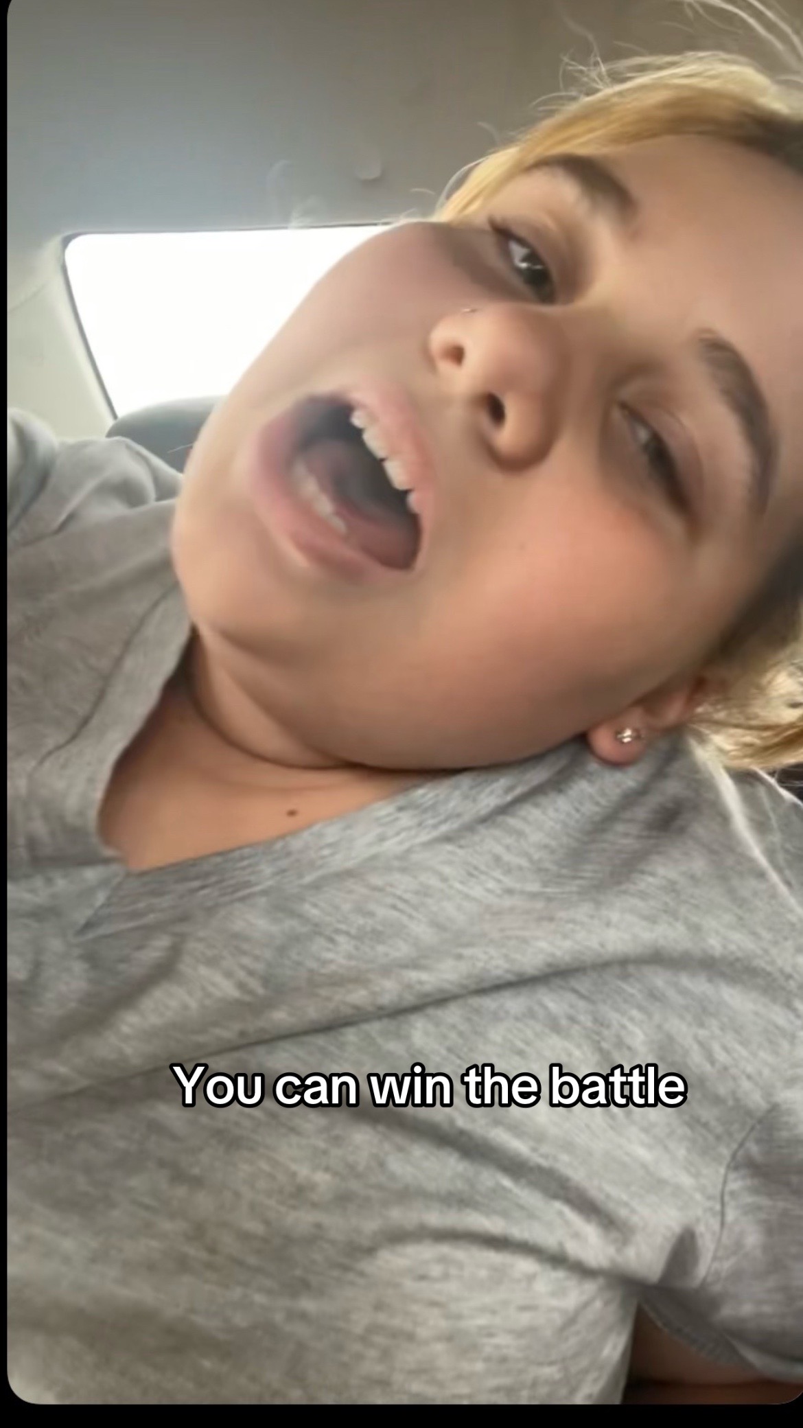 @ALIE