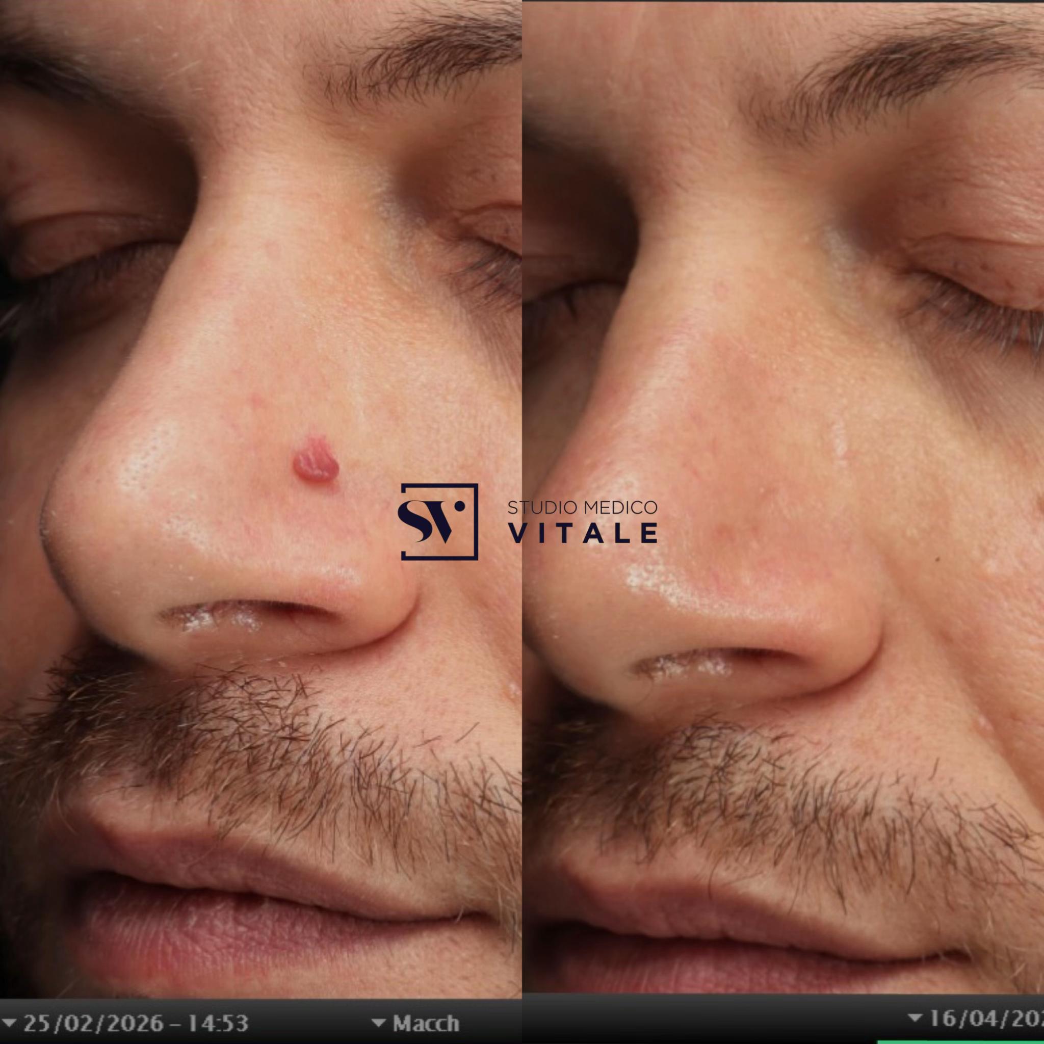 @Dr. Massimo Vitale