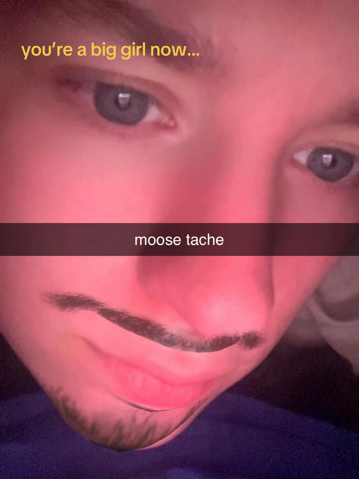 @Pika 🪳