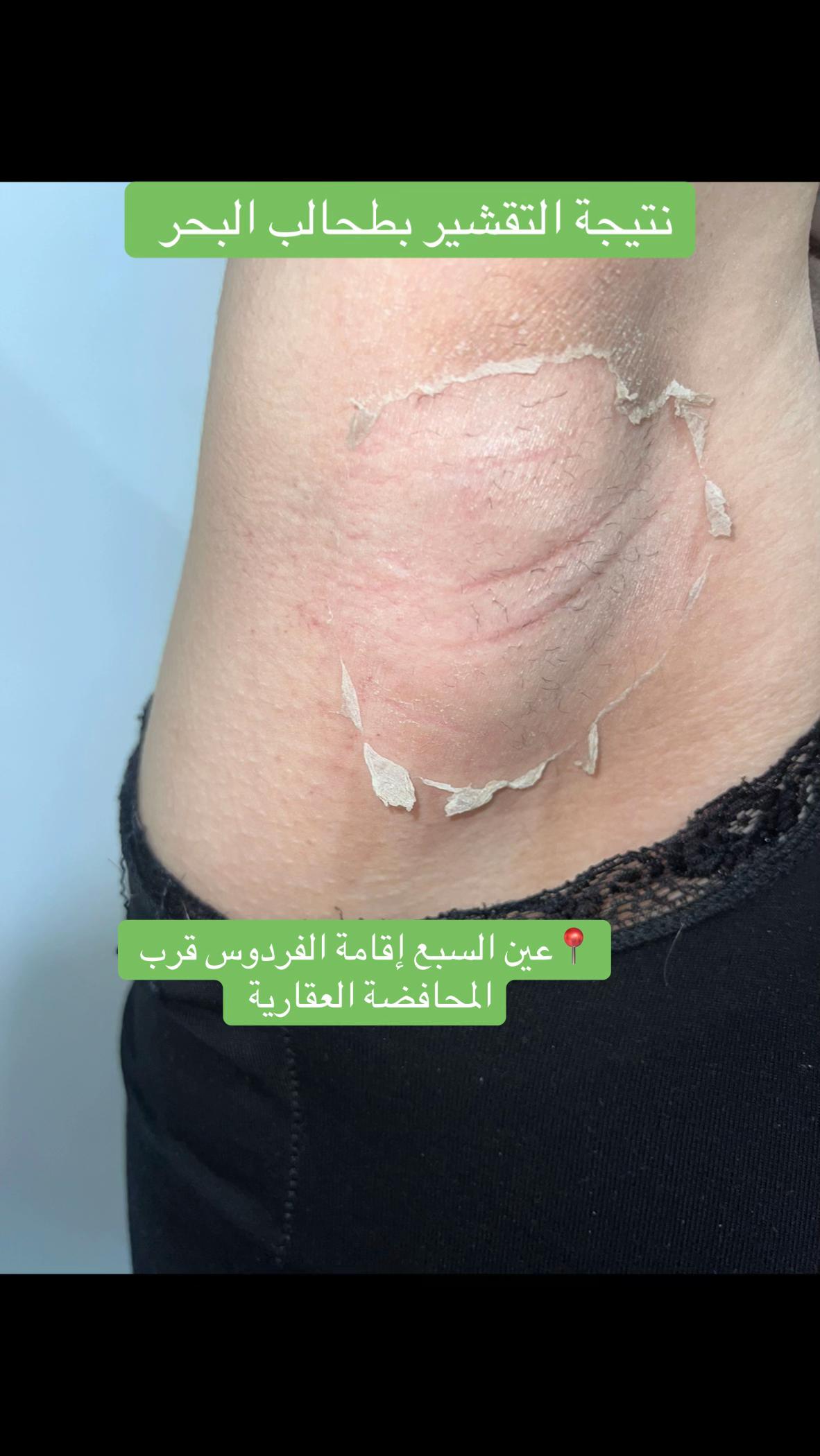 @oumayma_physio