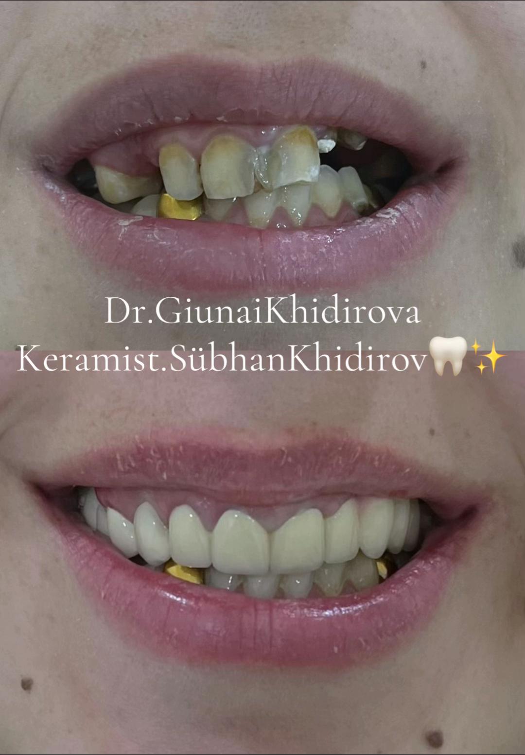 @Dr.Гюнай