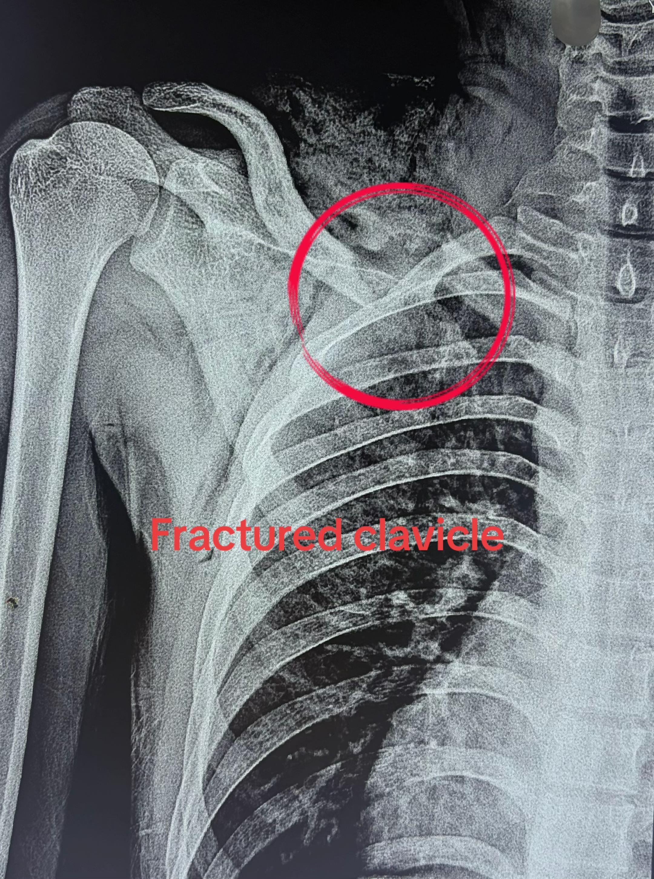 @Spine_Ortho_Surgeon_Arbind