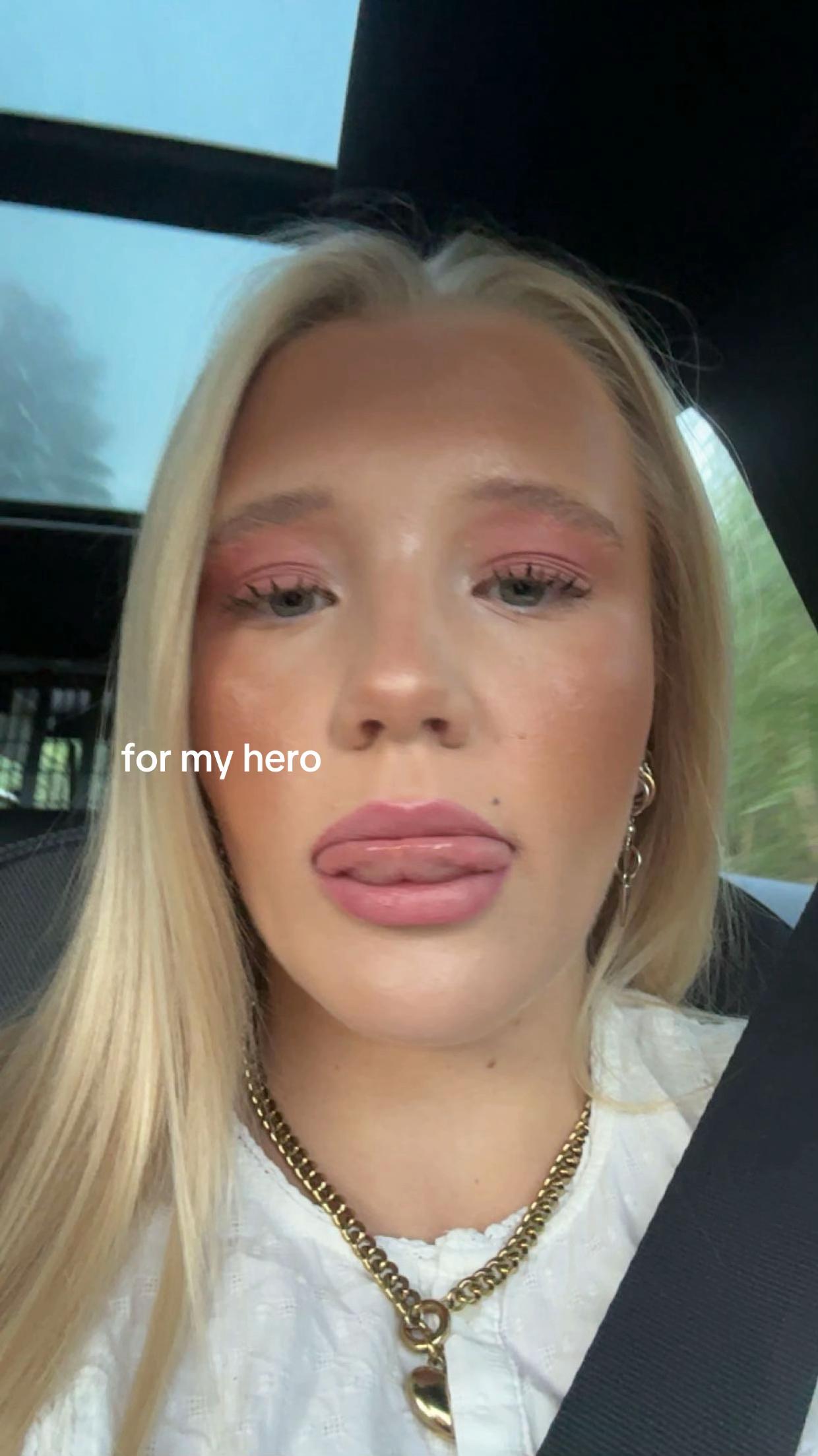 @Stella Hermansson