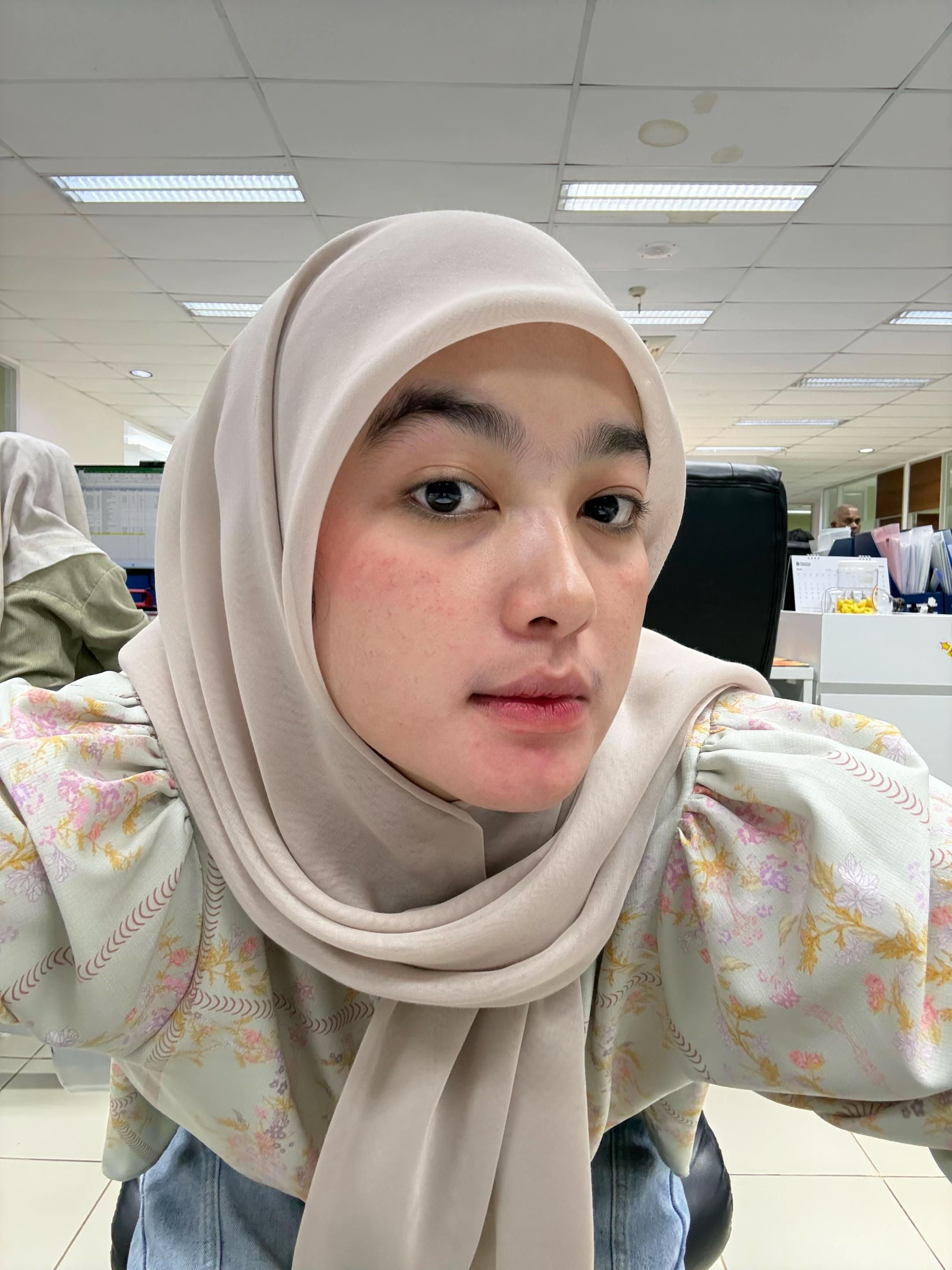 @alya
