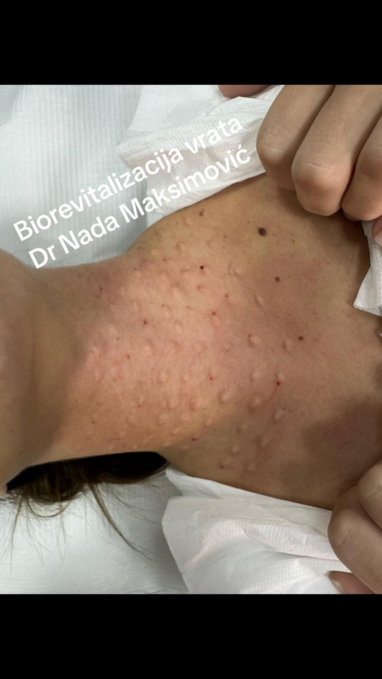 @Dr Nada Maksimovic