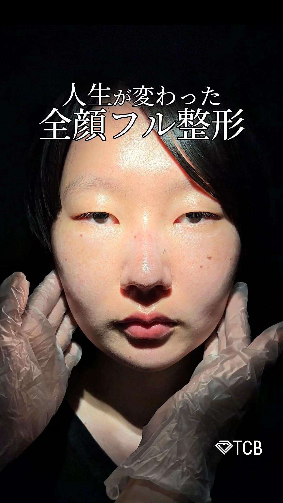 @【二重整形】TCB 新宿東口院ゆいこ先生/東京