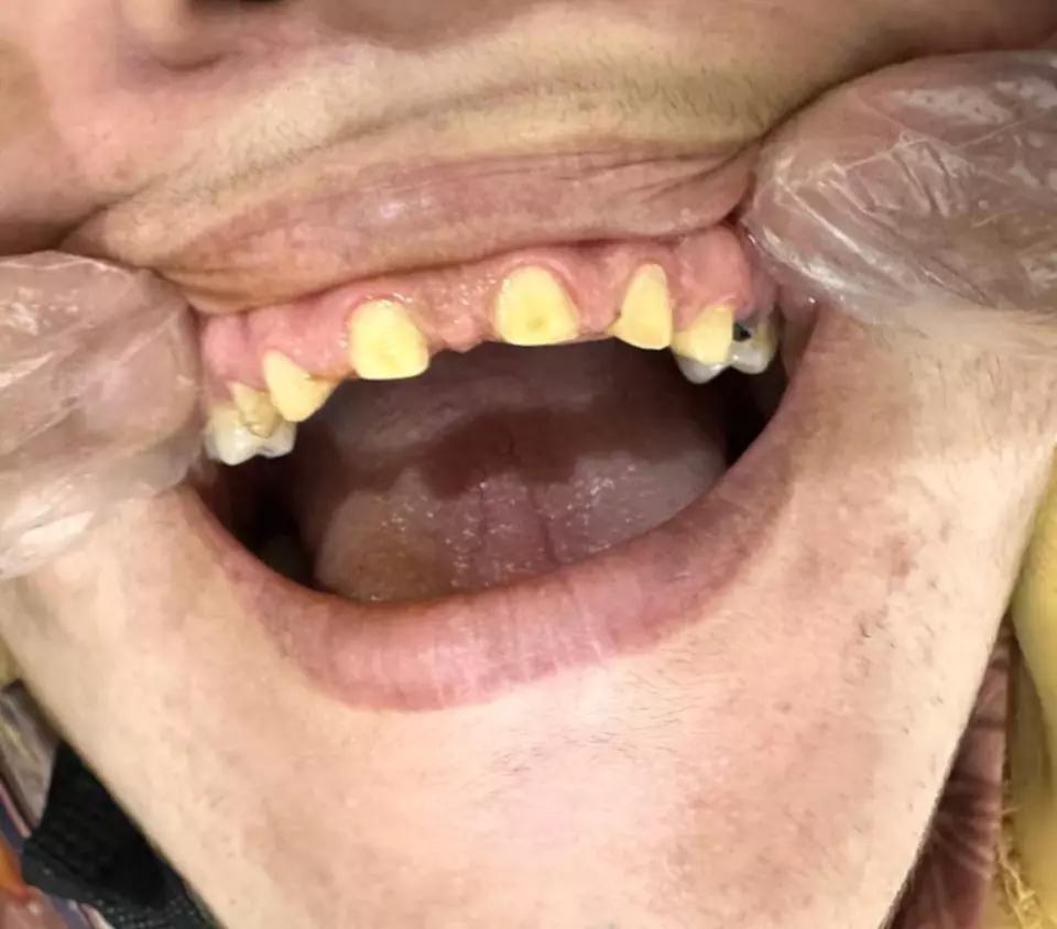 @Dr Adil khan 🦷🦷
