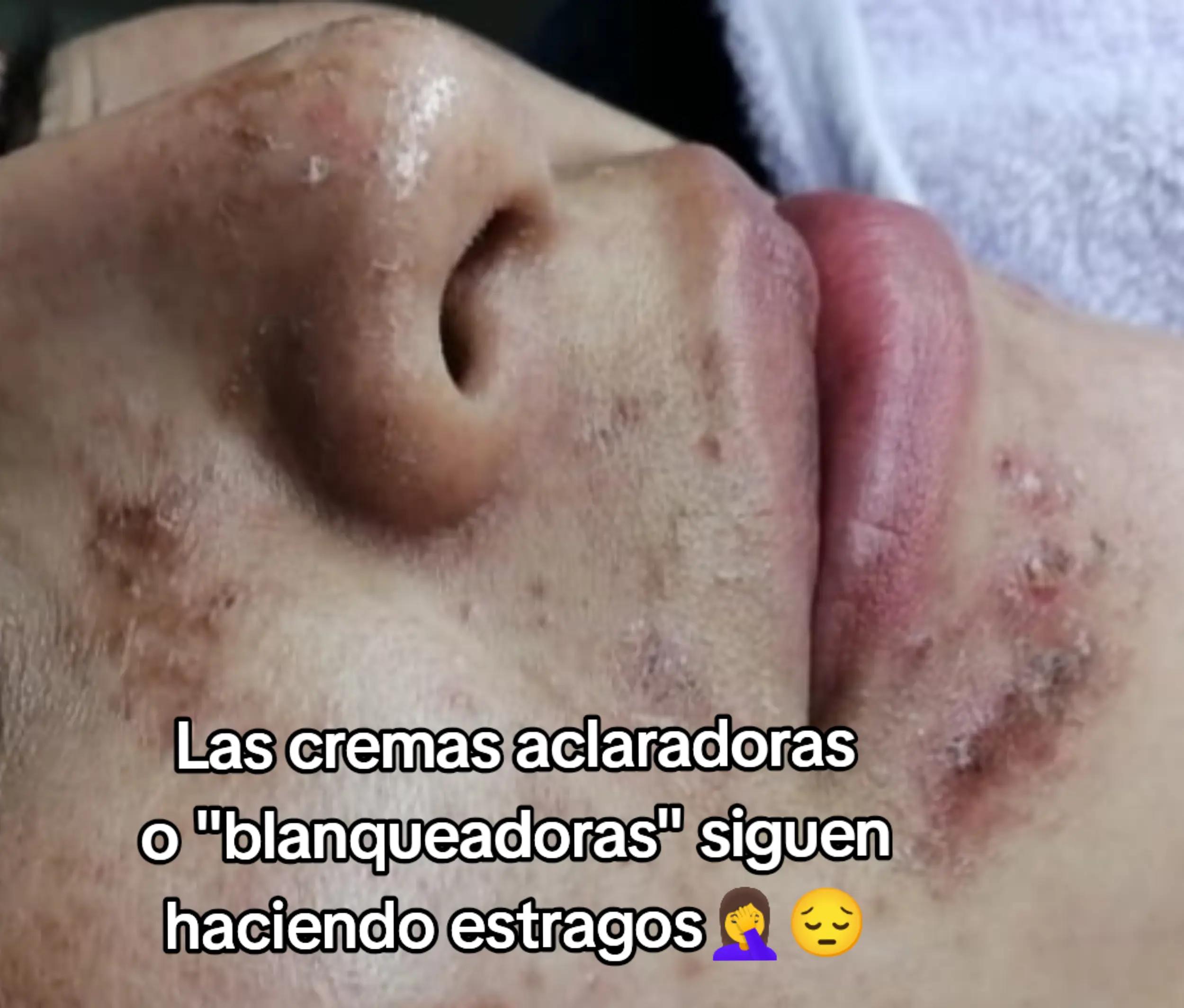 @MunayDermocuidados