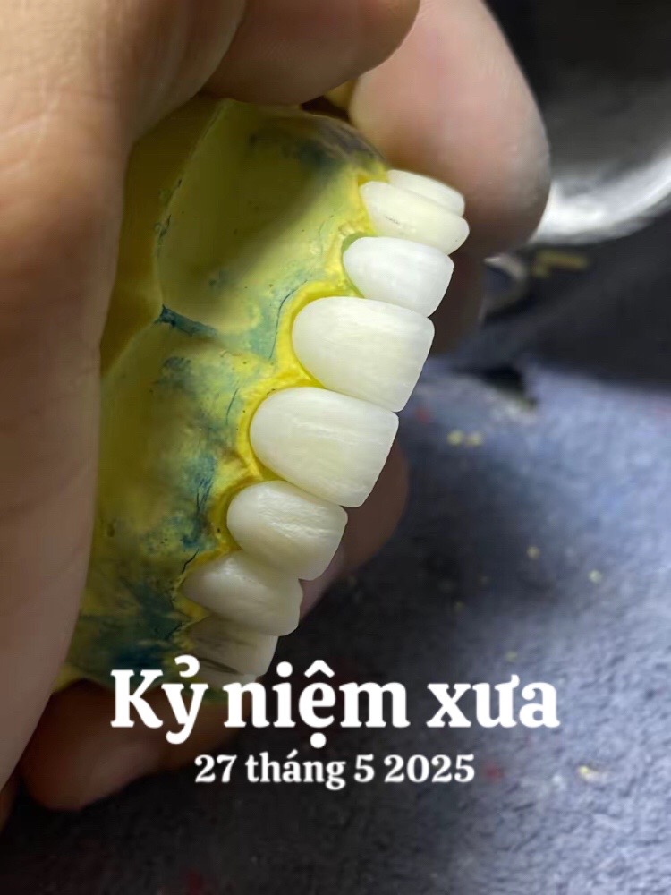 @Hùng răng sứ 🦷🦷