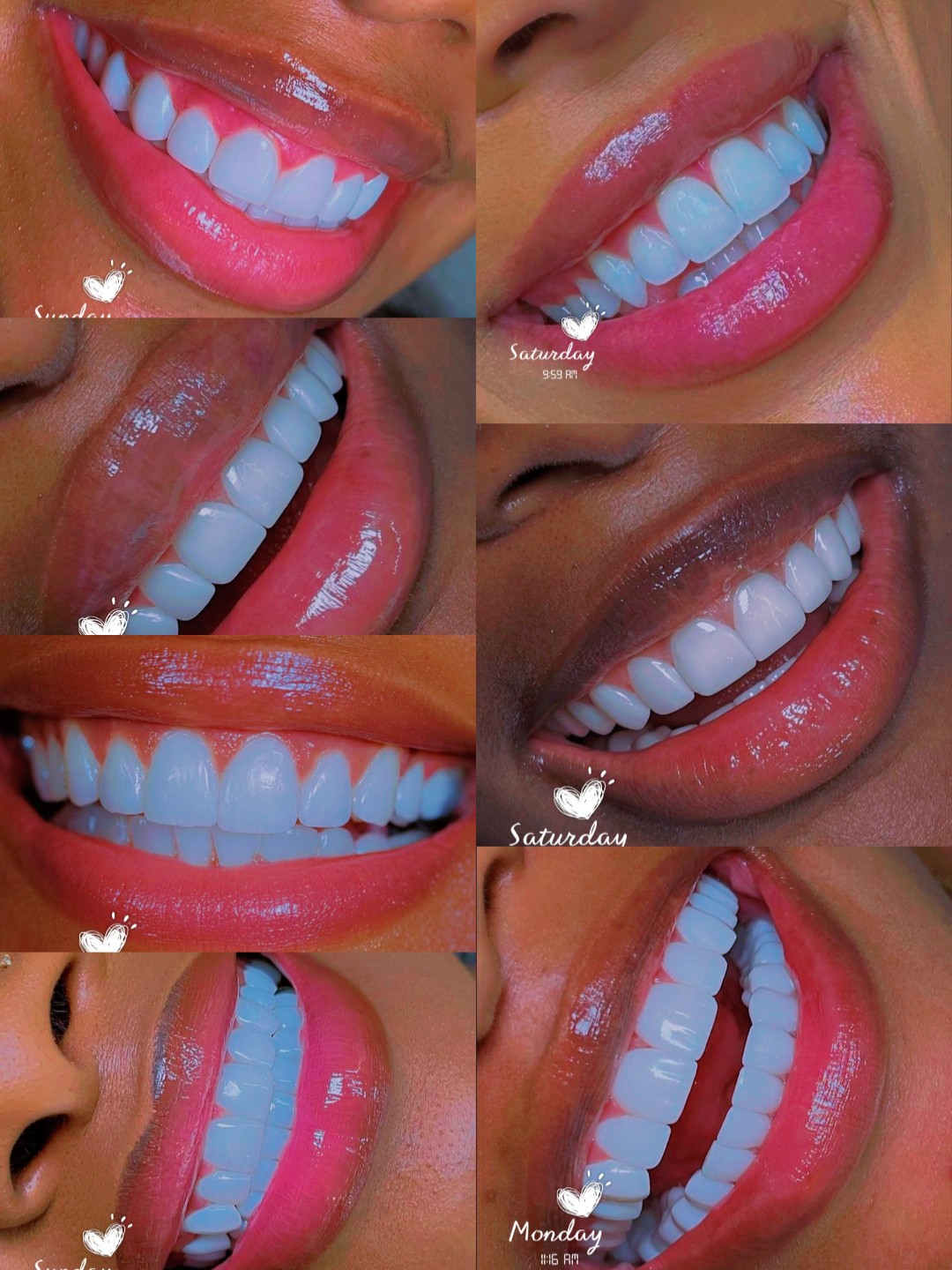 @Dr.Naasir🦷🩵🩺